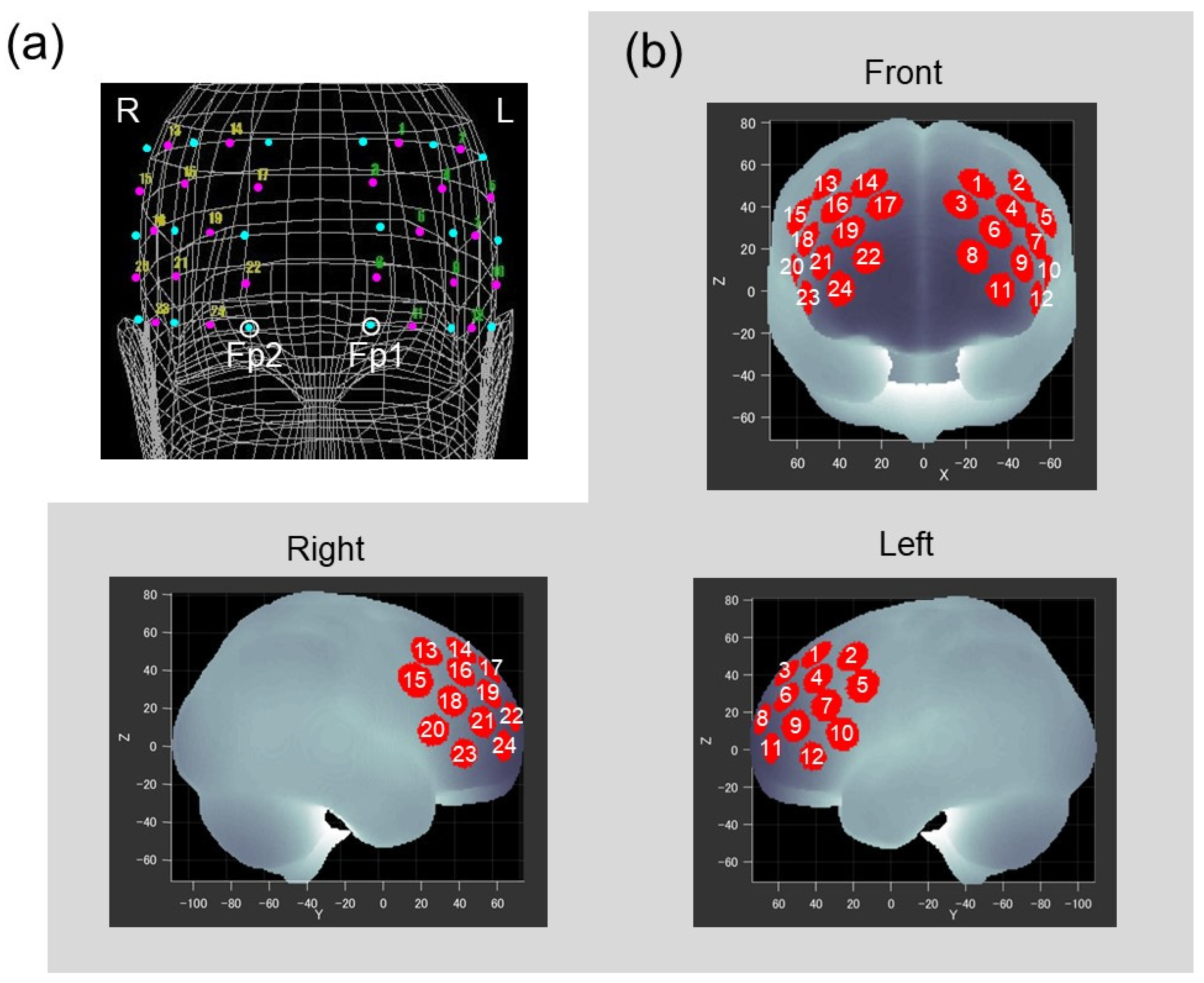Brainsci 13 00758 g002