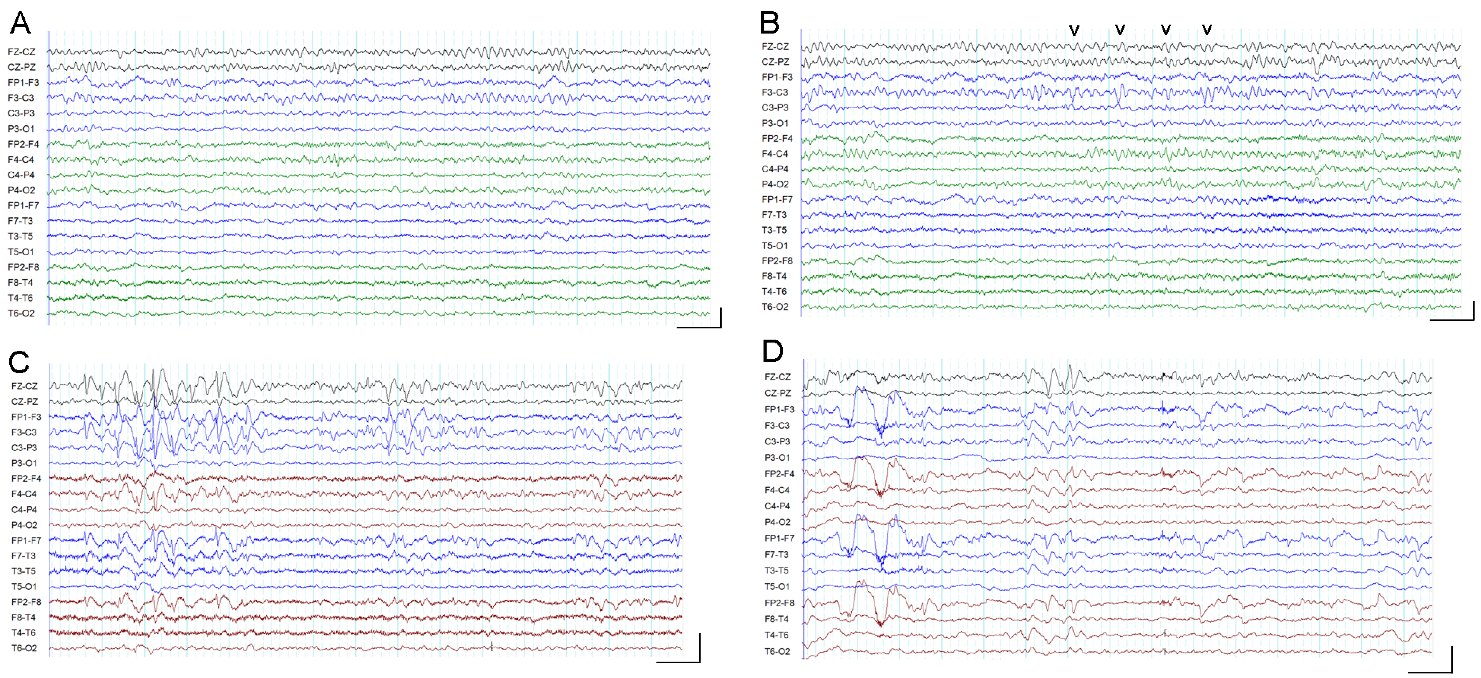 Brainsci 13 00760 g001
