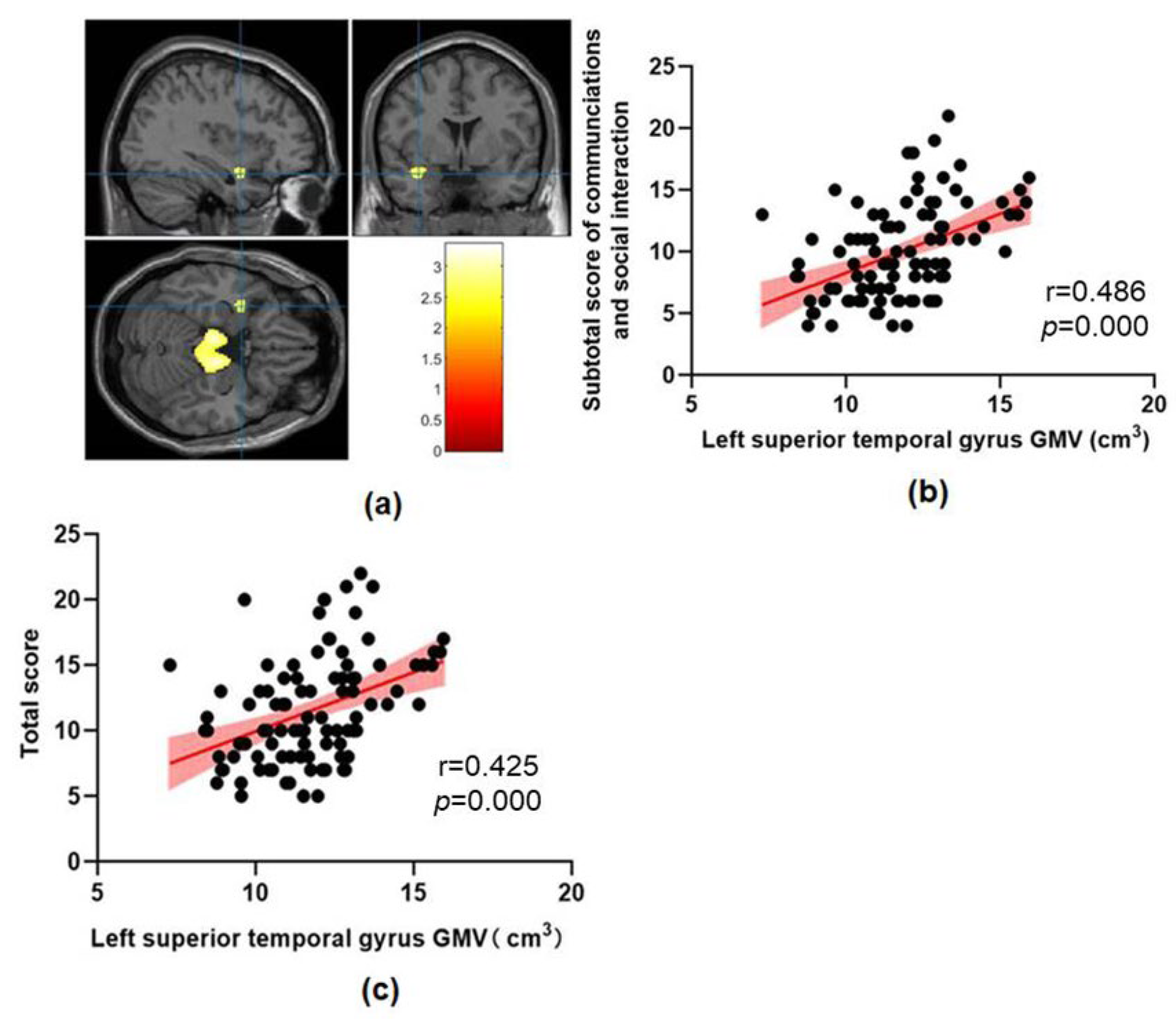 Brainsci 13 00779 g002 Brainsci 13 00779 g002