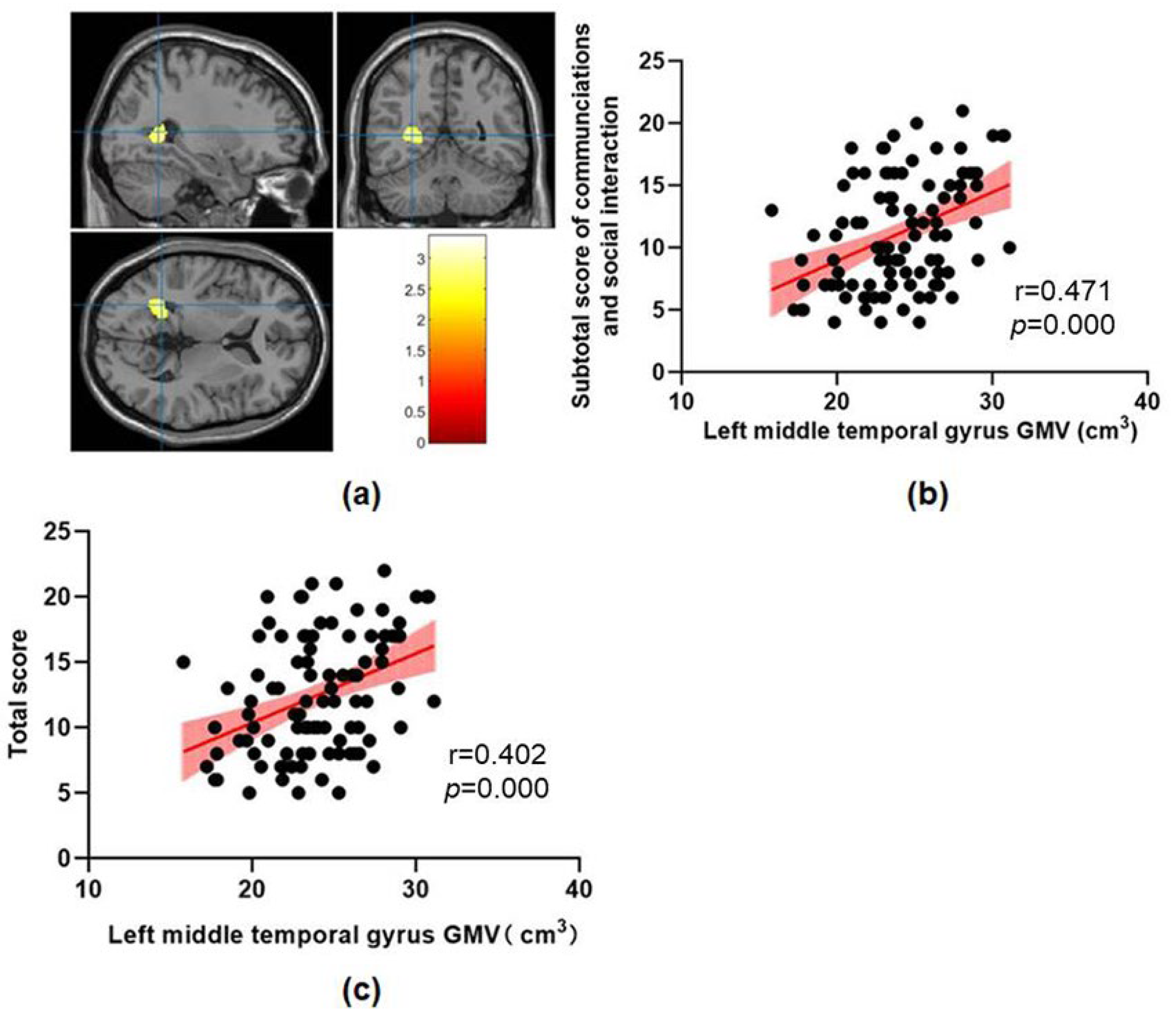 Brainsci 13 00779 g003 Brainsci 13 00779 g003
