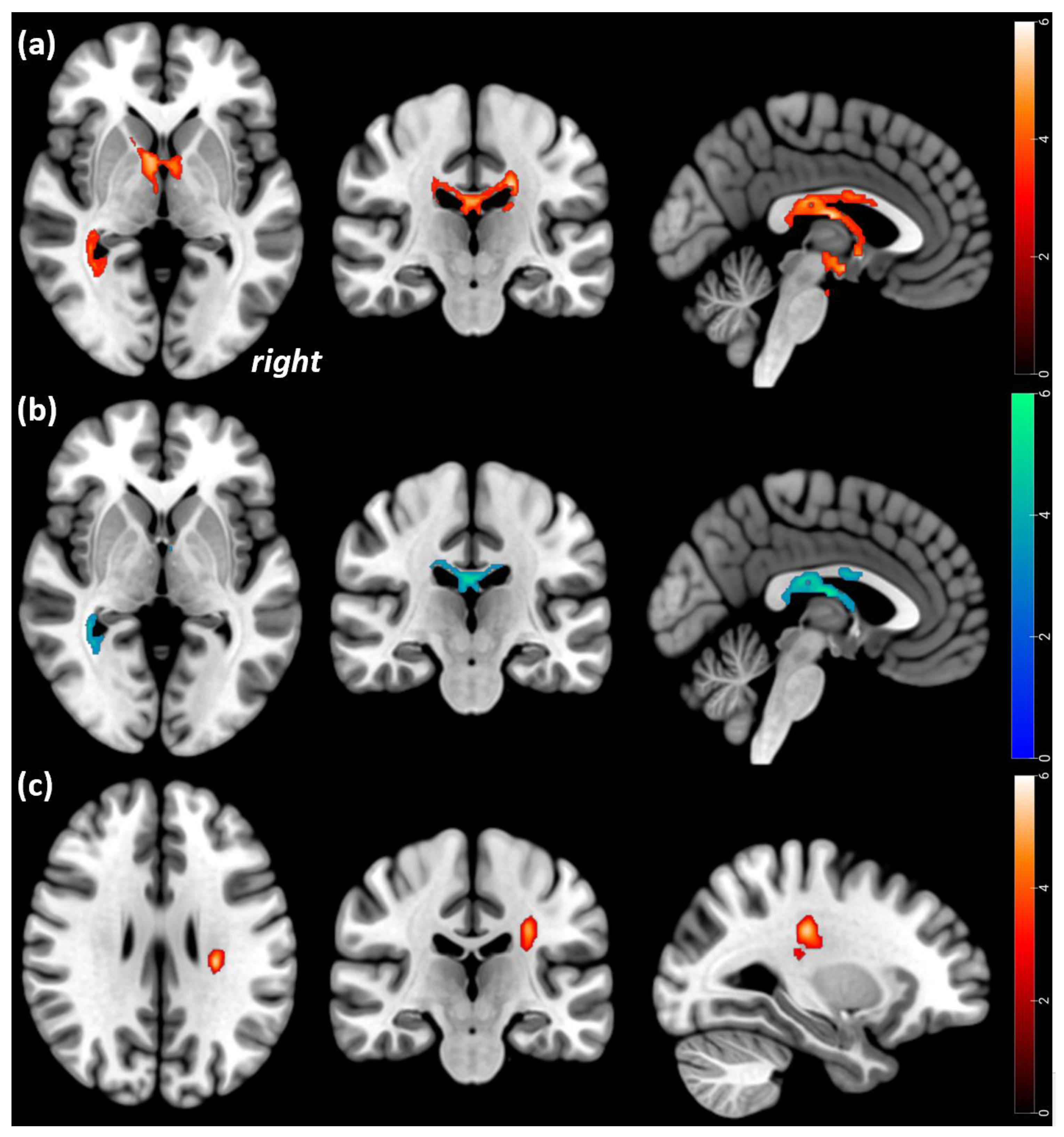 Brainsci 13 00798 g001