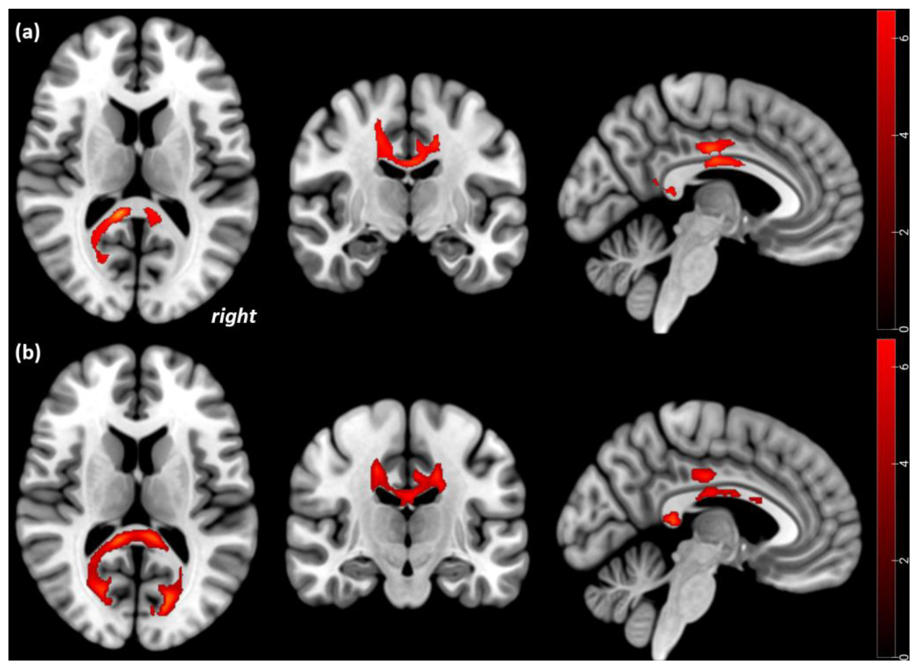 Brainsci 13 00798 g002