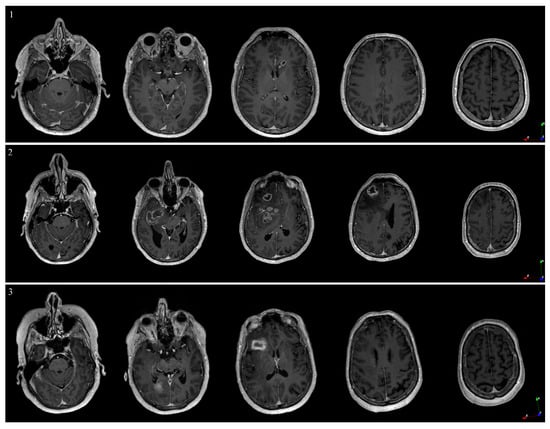 Brainsci 13 00809 g0a3