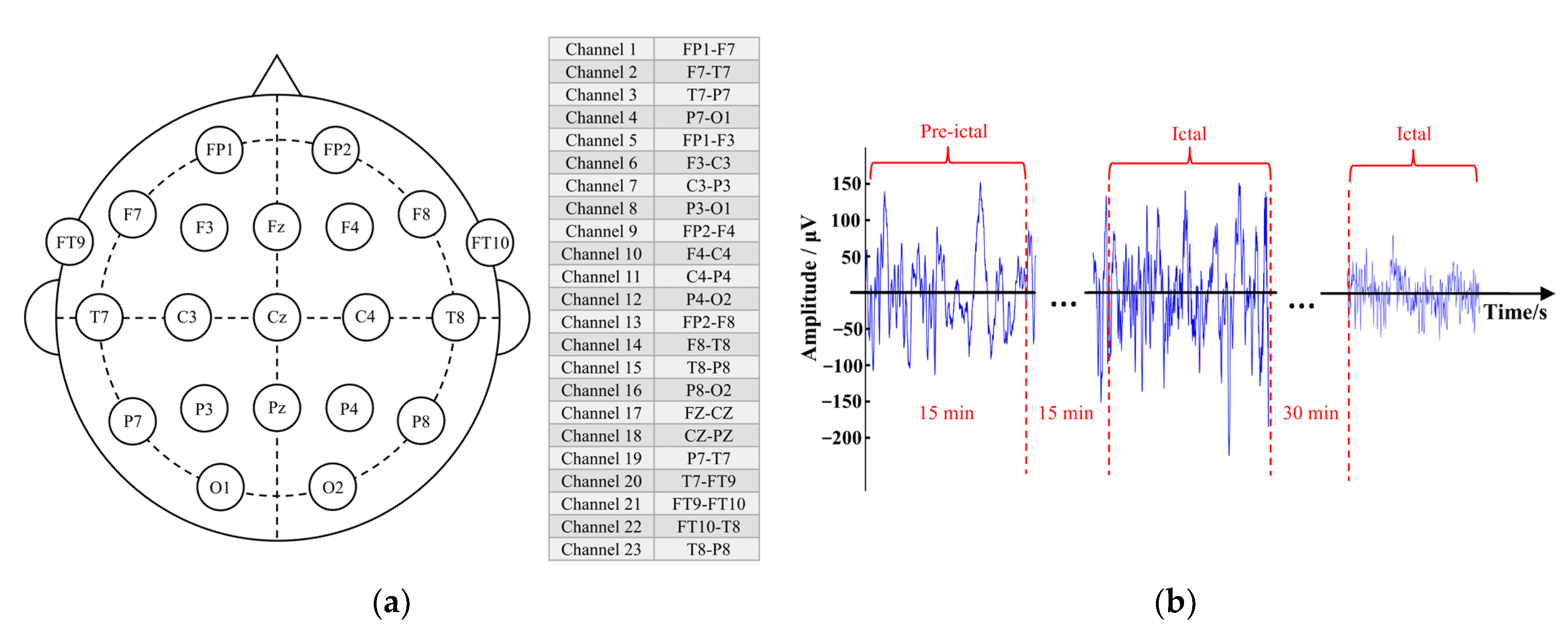 Brainsci 13 00820 g002
