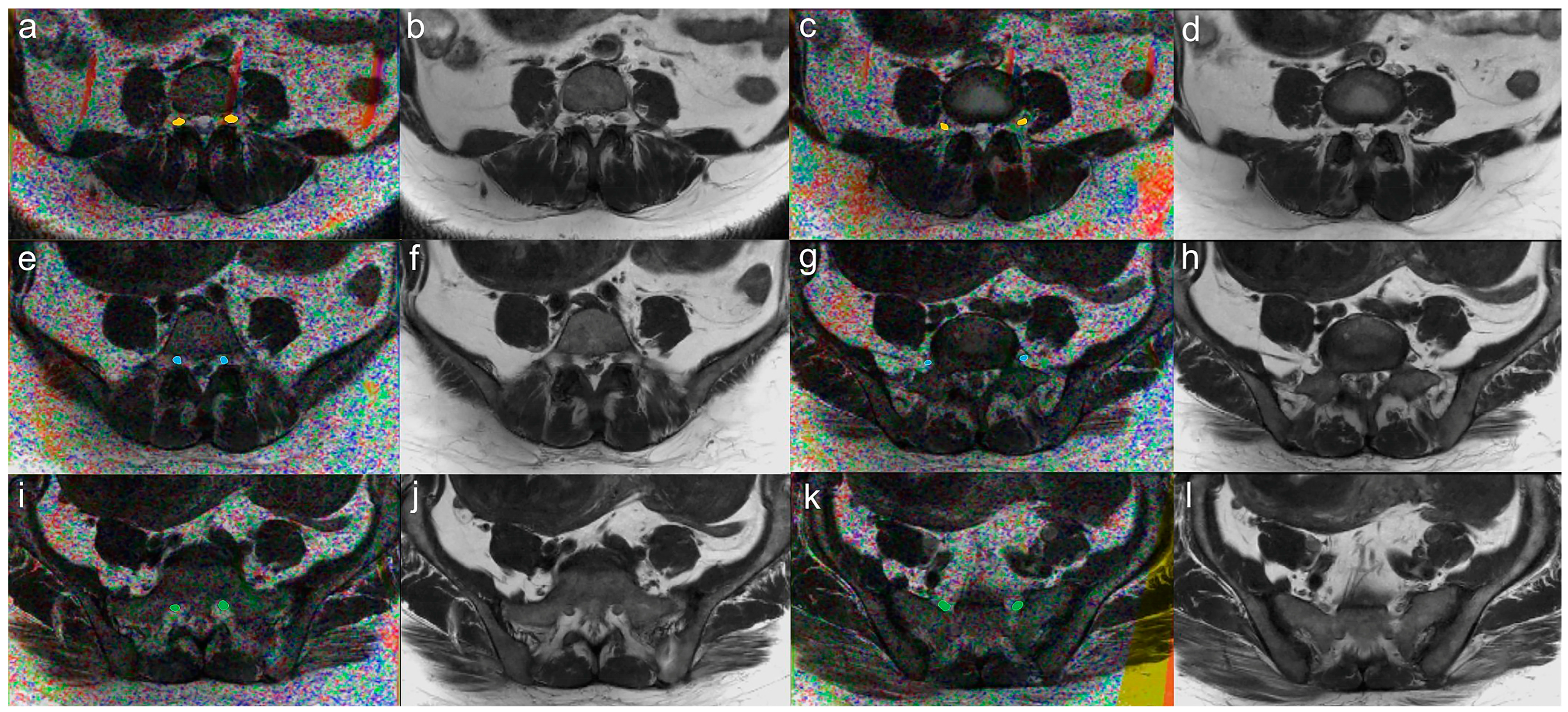 Brainsci 13 00828 g001