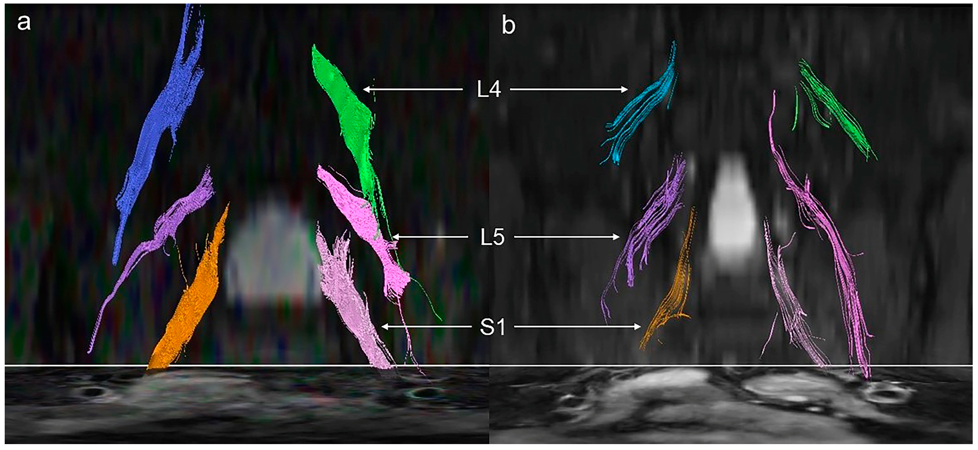 Brainsci 13 00828 g002
