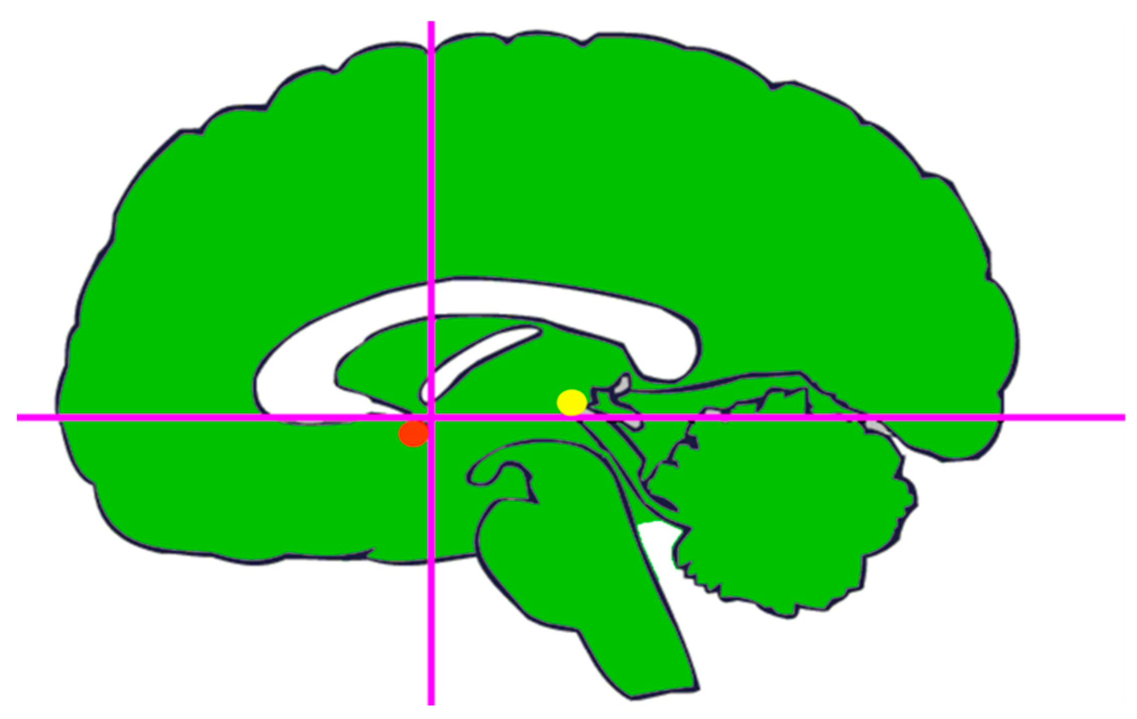Brainsci 13 00830 g002