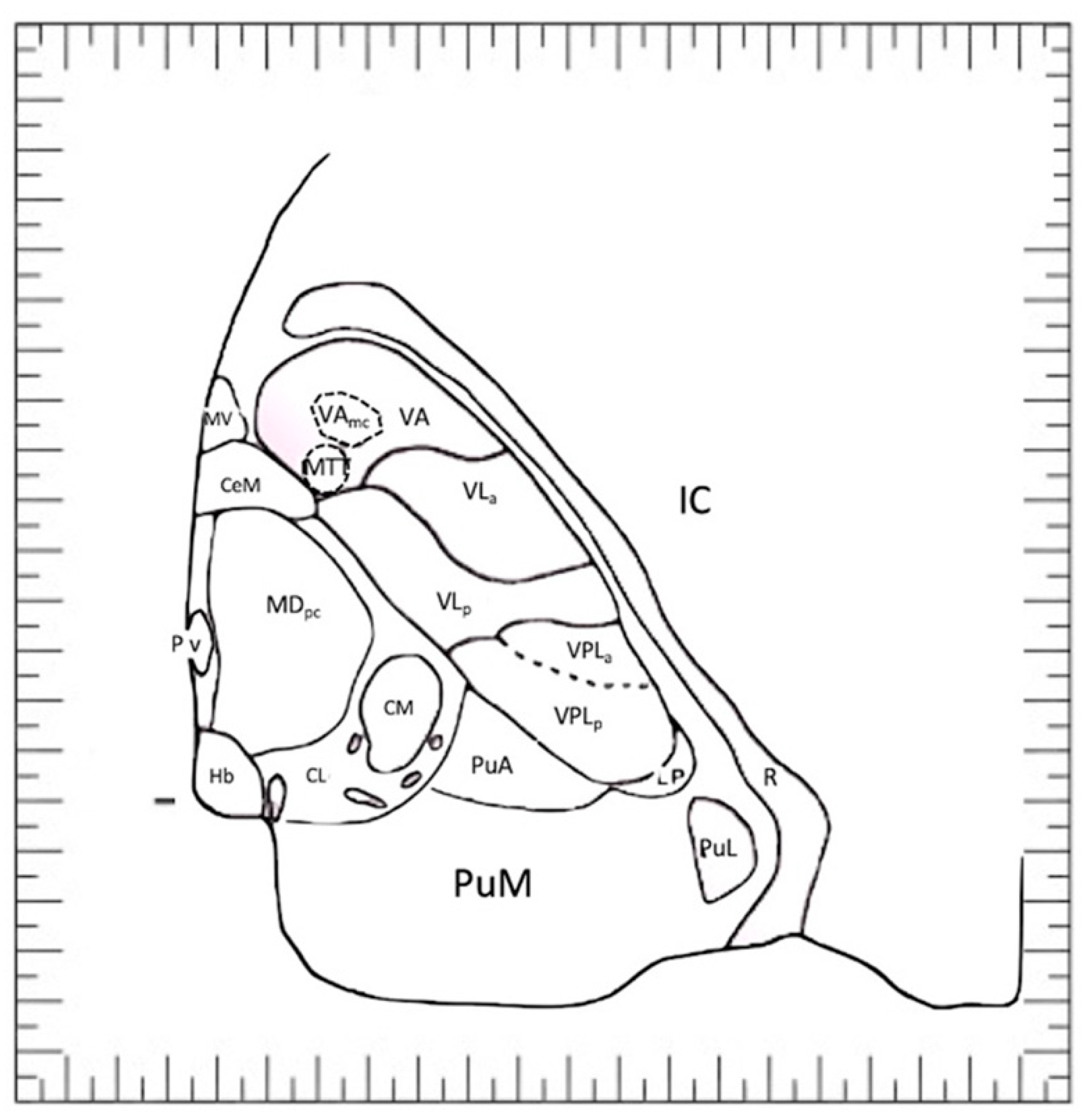 Brainsci 13 00830 g008