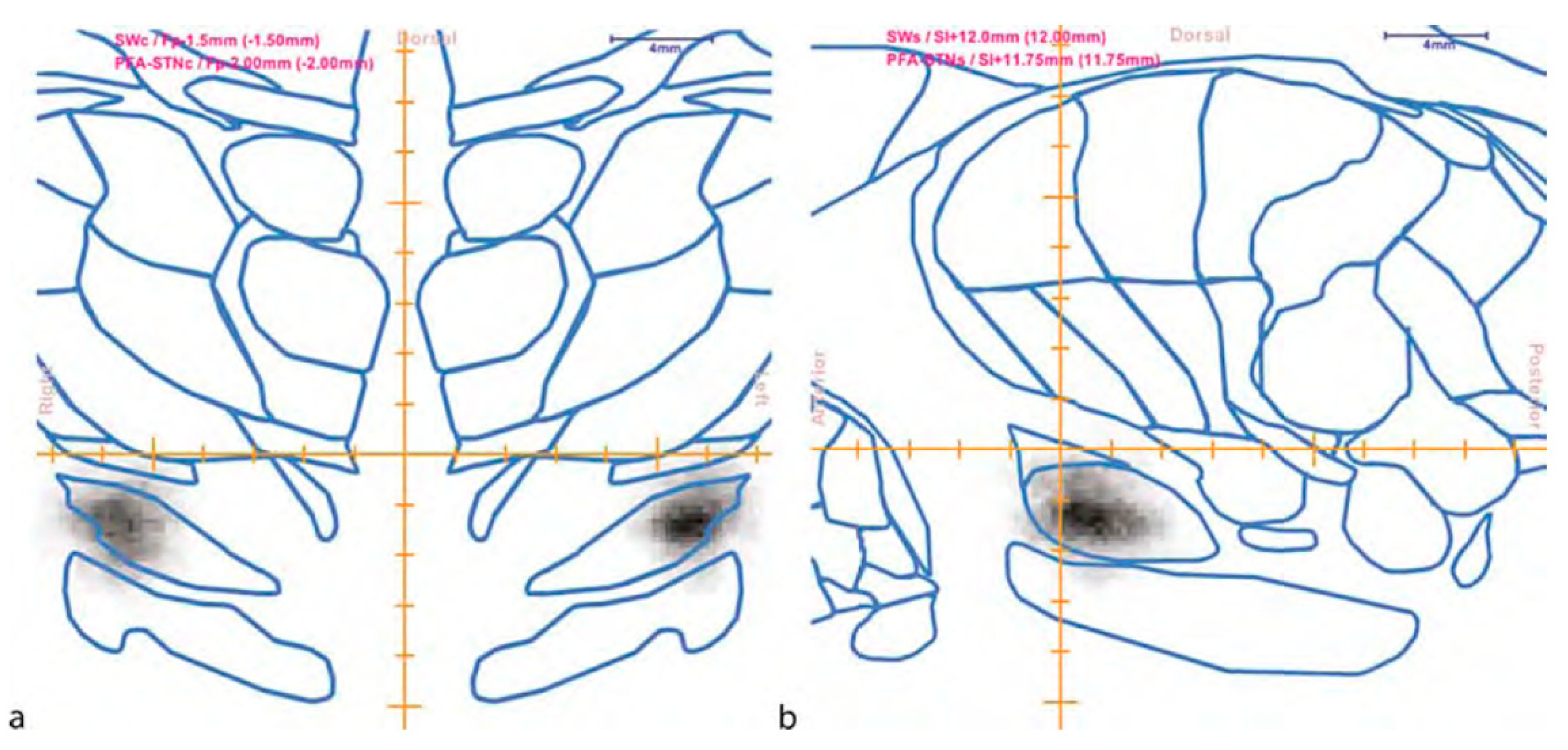 Brainsci 13 00830 g011