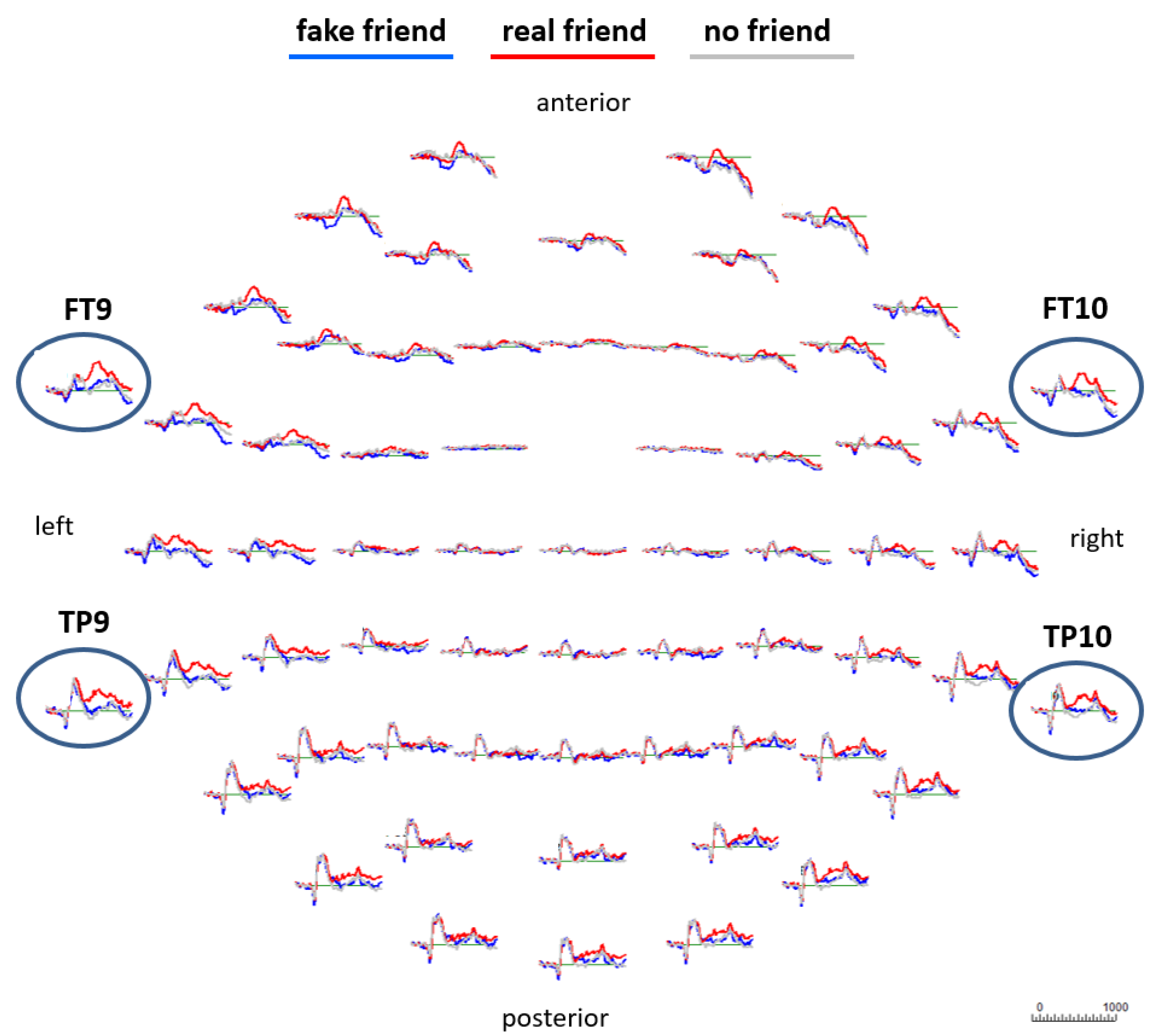 Brainsci 13 00831 g001