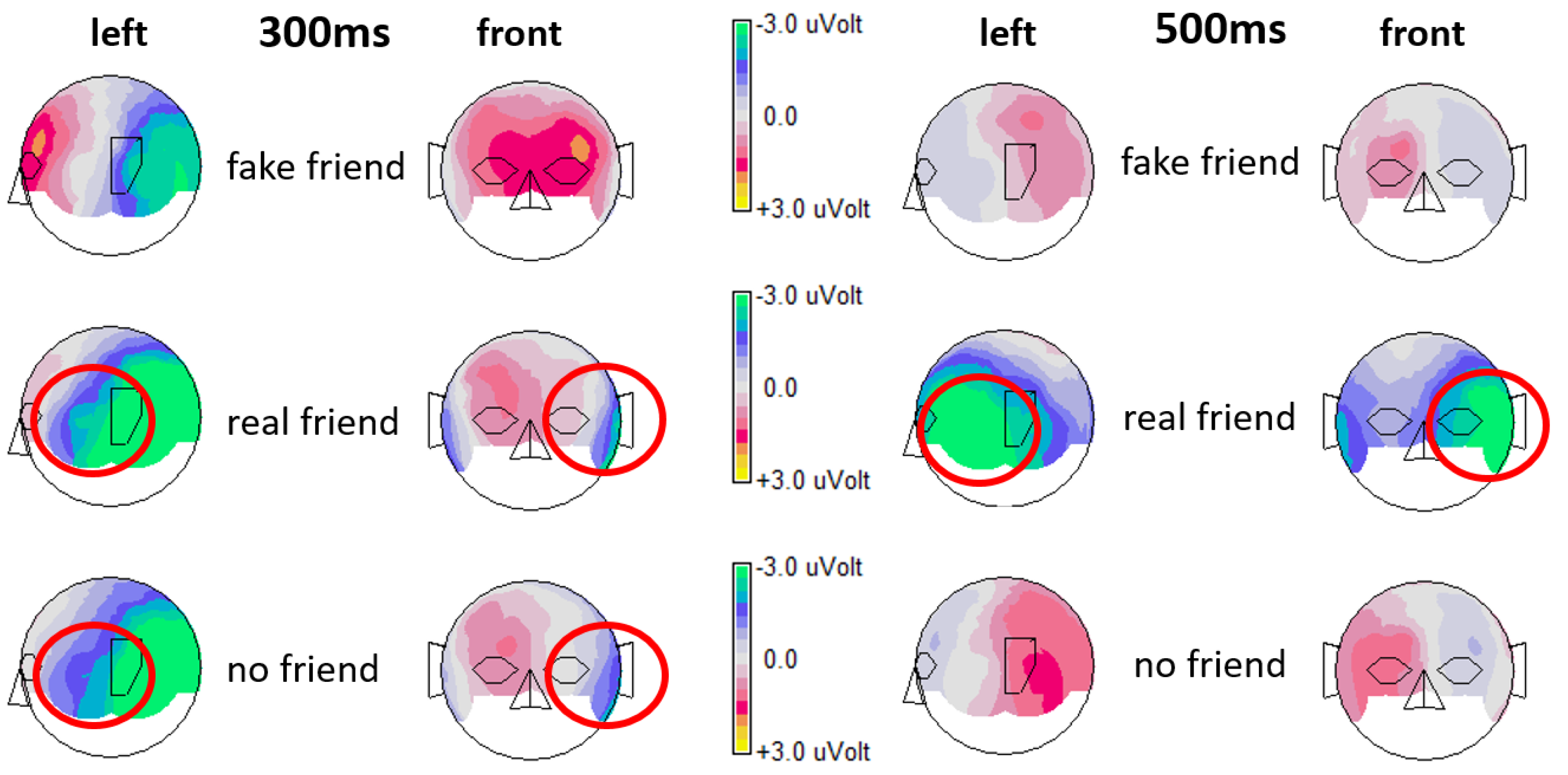 Brainsci 13 00831 g003