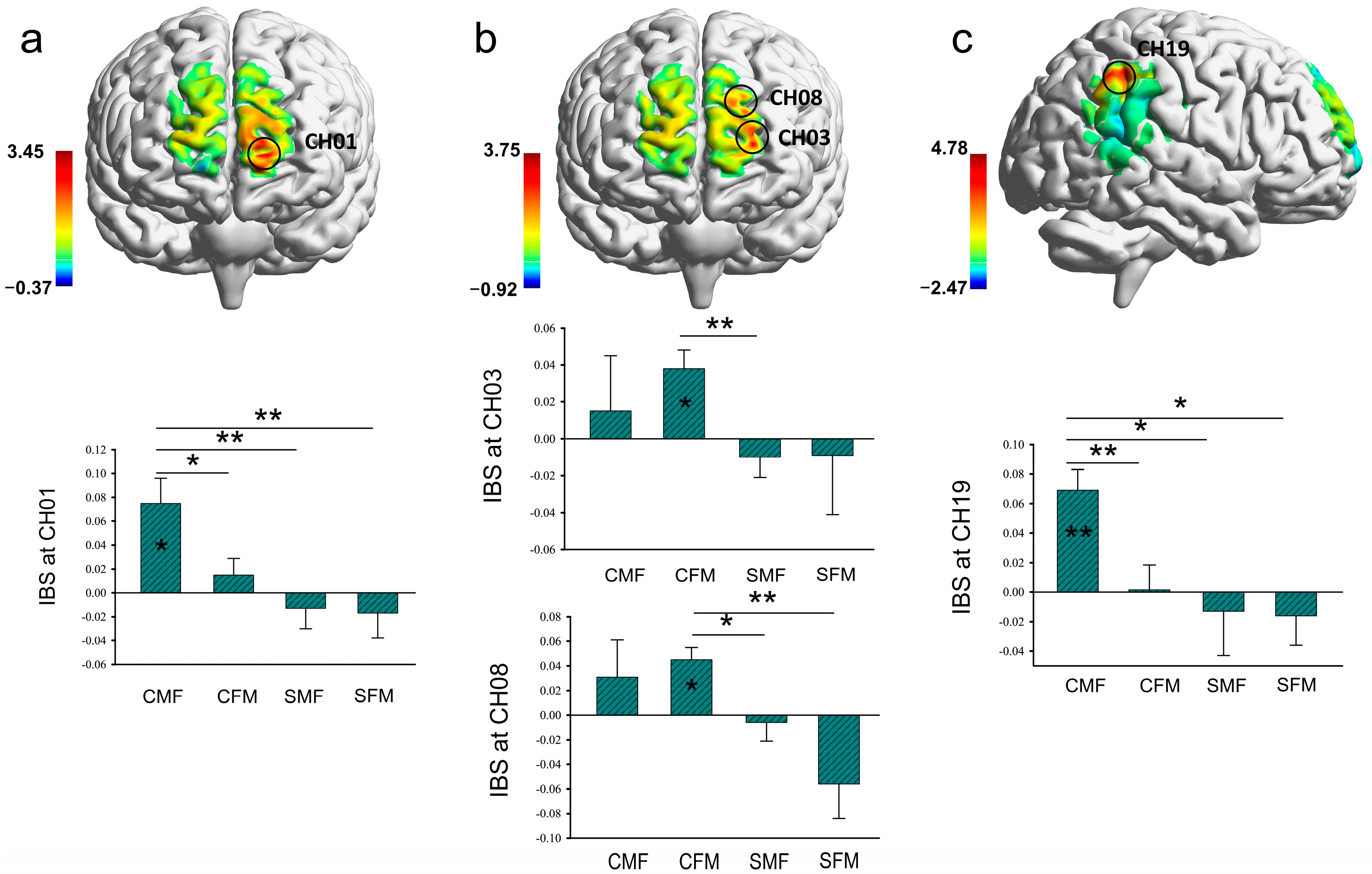 Brainsci 13 00833 g004
