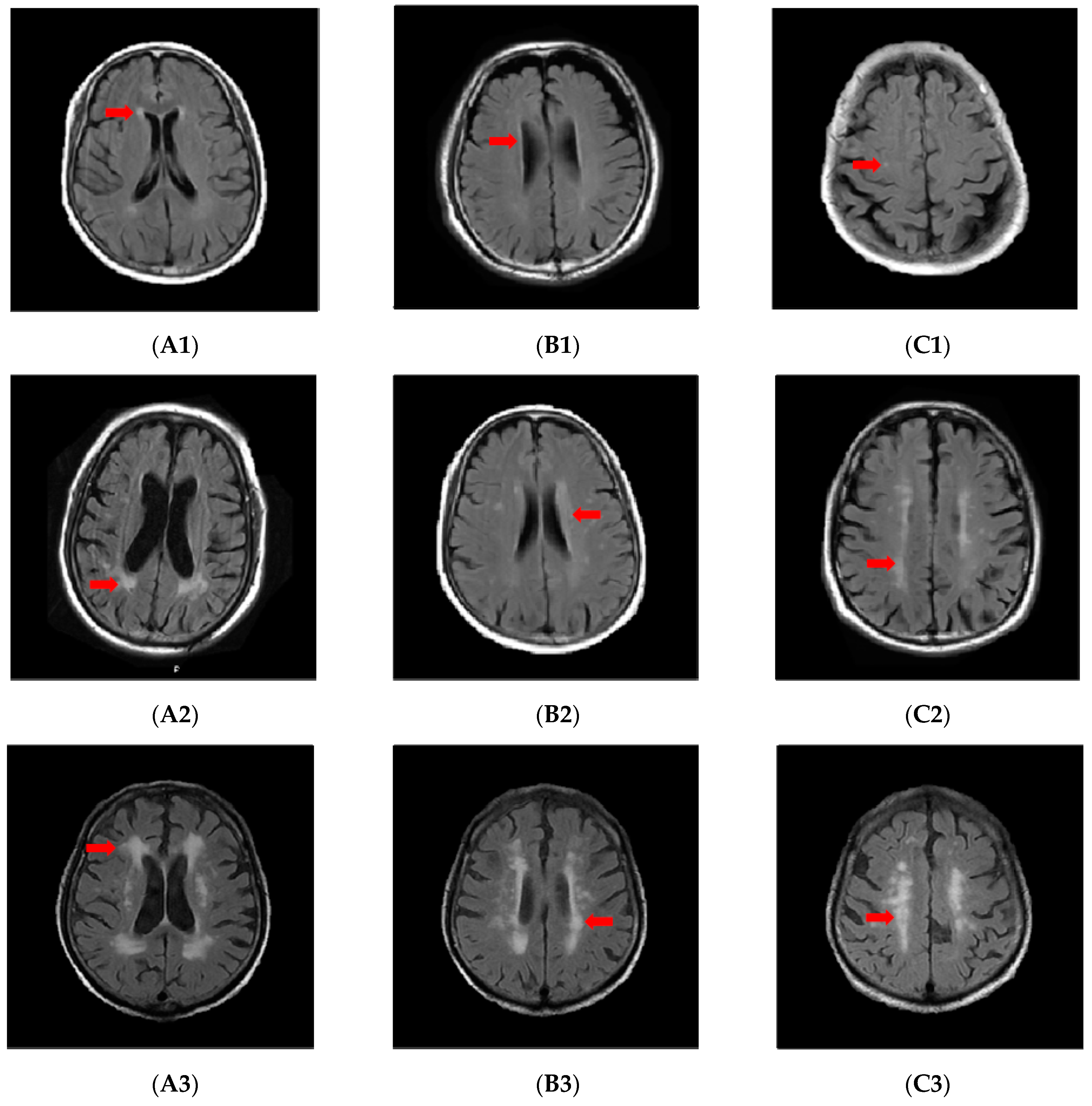 Brainsci 13 00835 g001