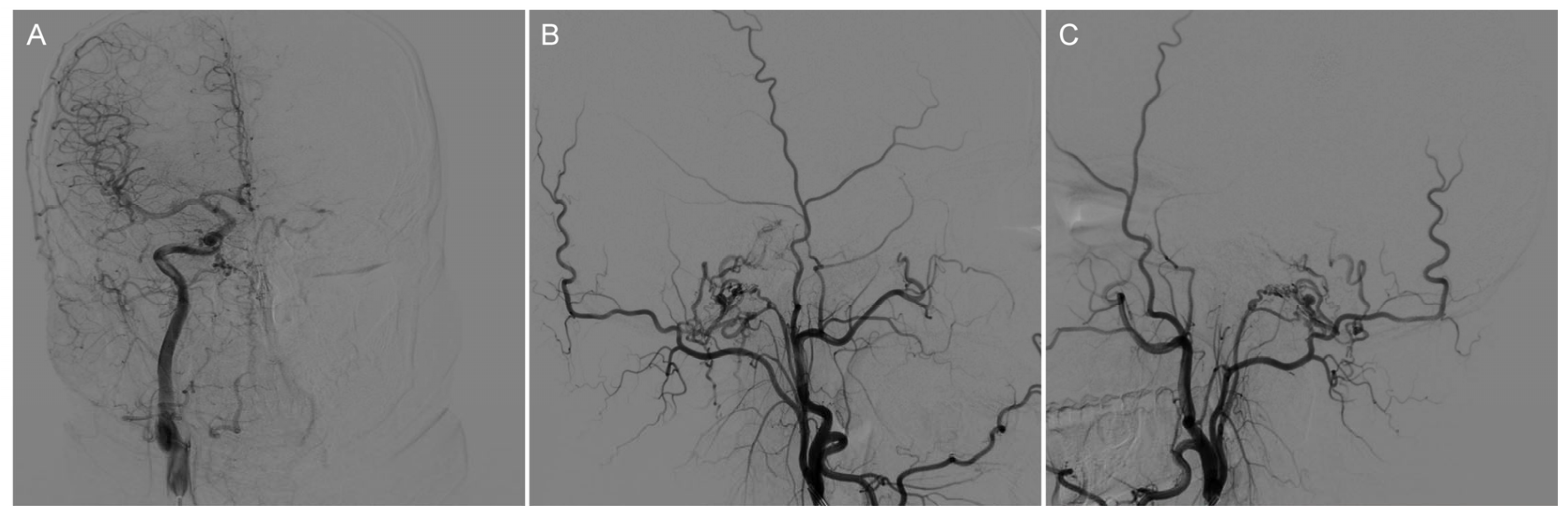 Brainsci 13 00839 g002