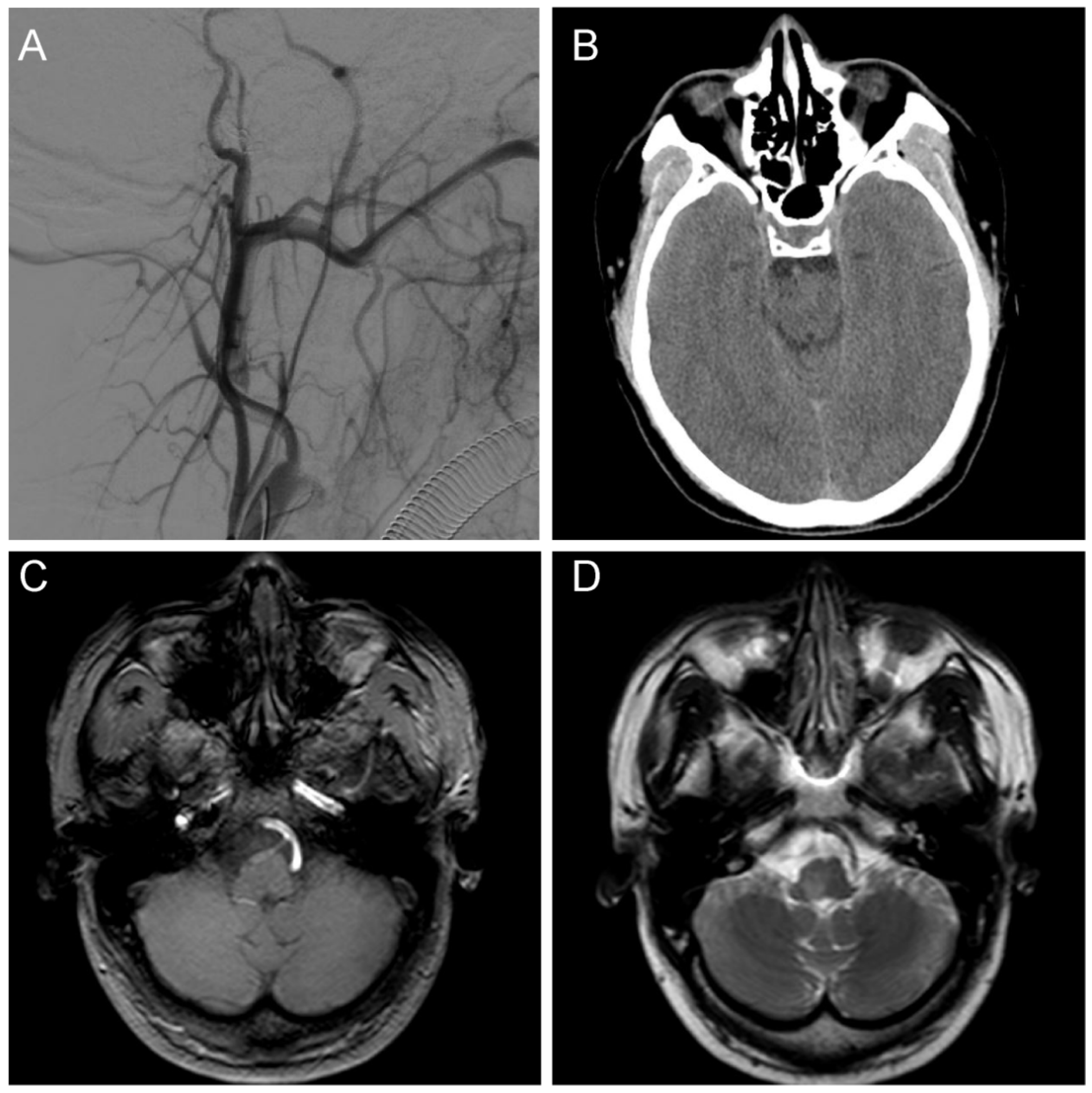 Brainsci 13 00839 g004