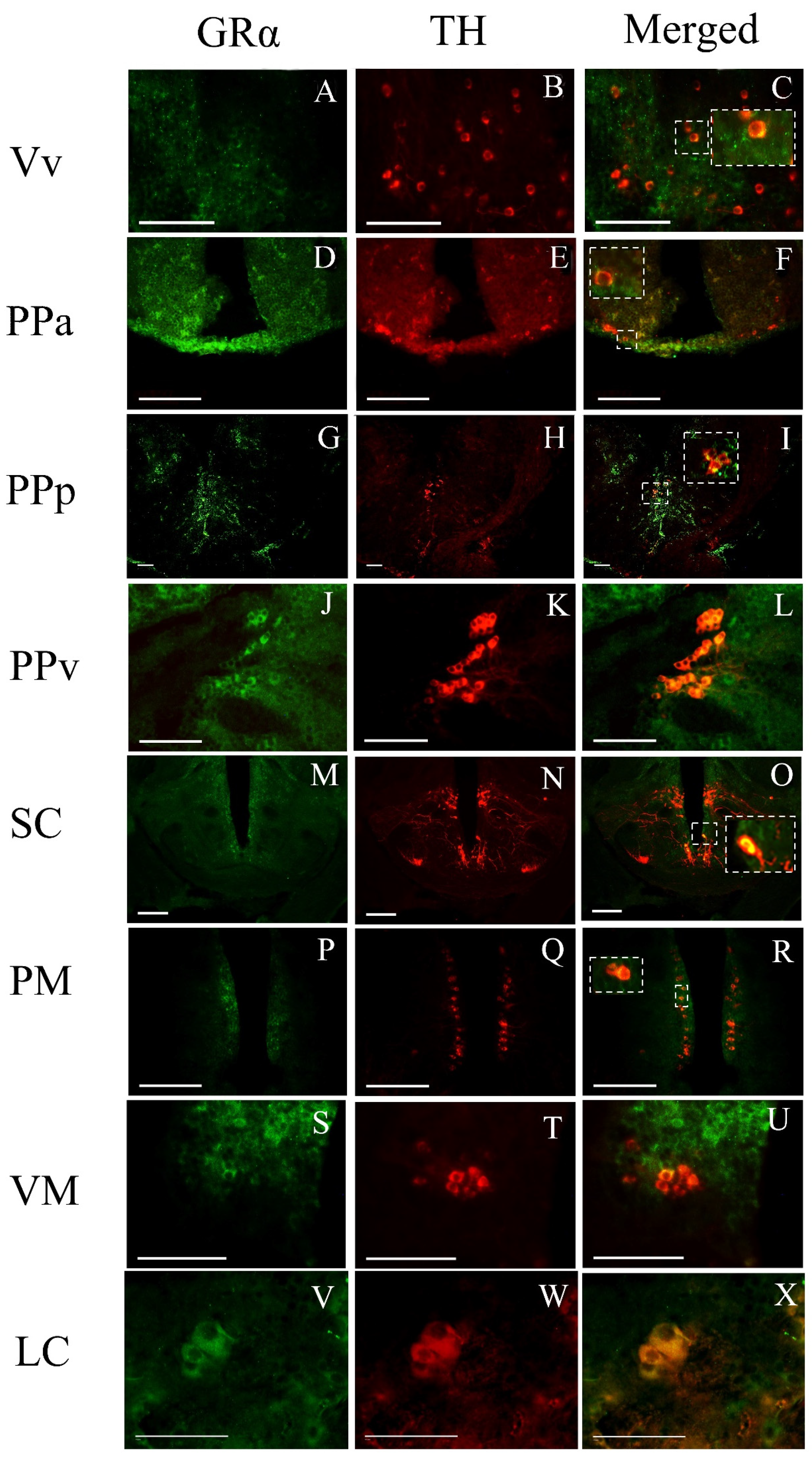 Brainsci 13 00861 g006