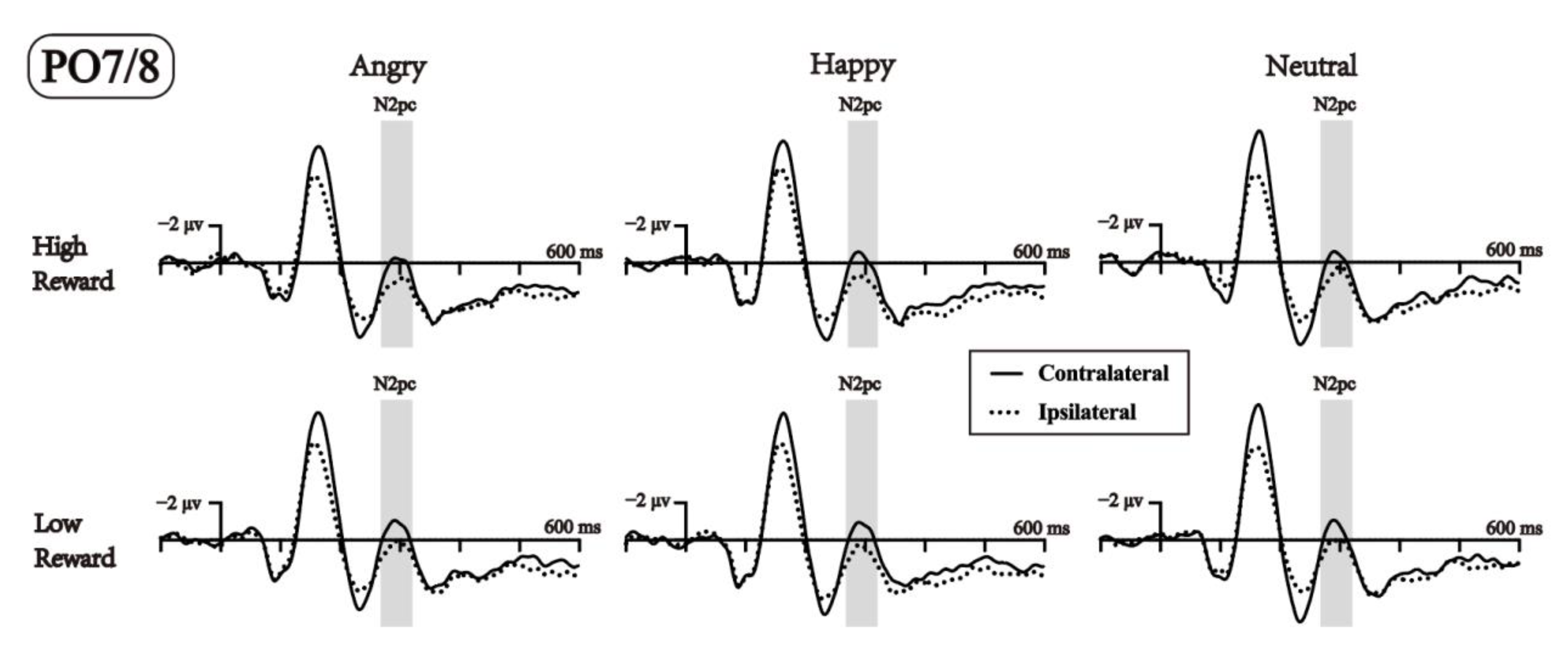 Brainsci 13 00874 g005