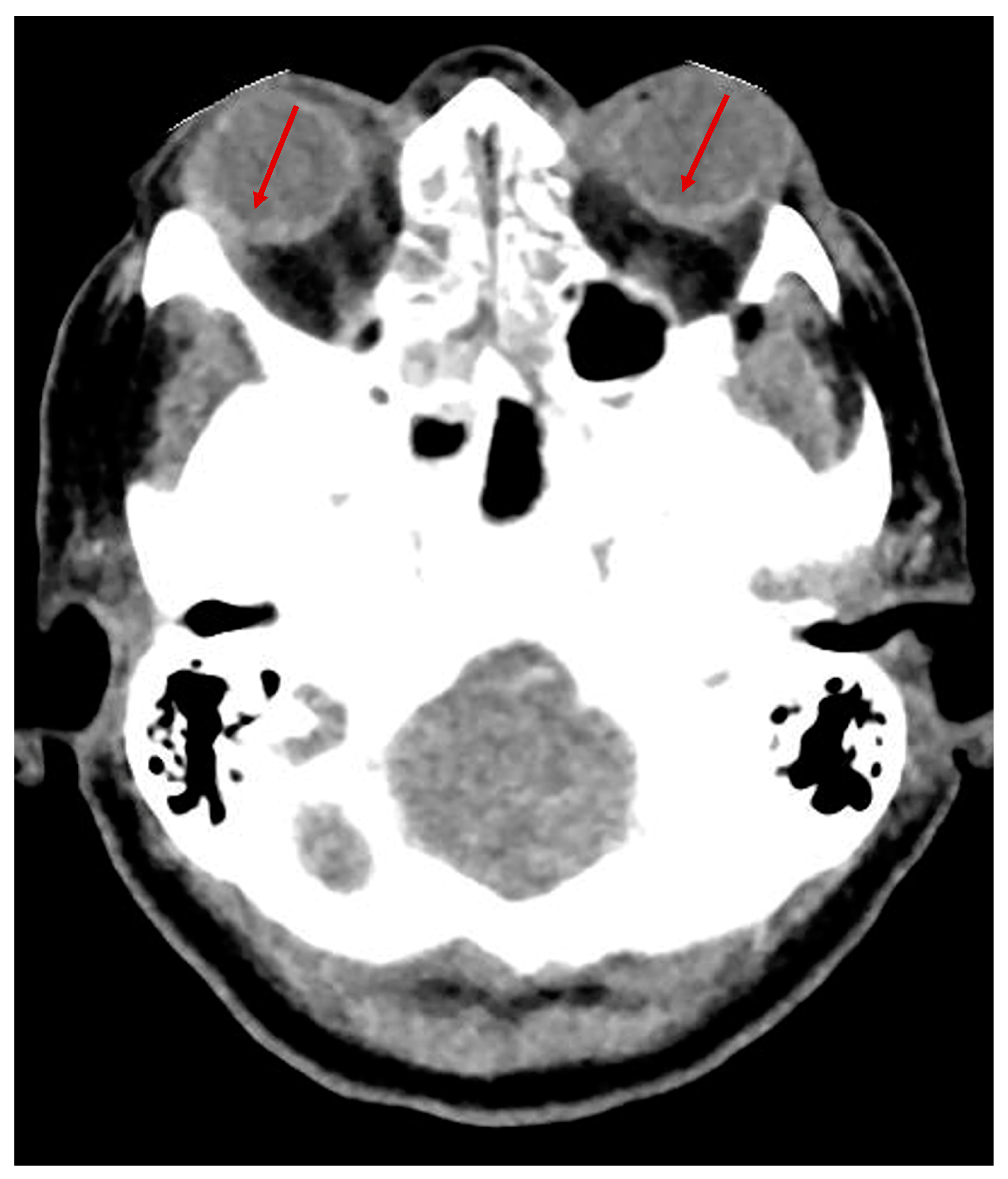 Brainsci 13 00879 g001