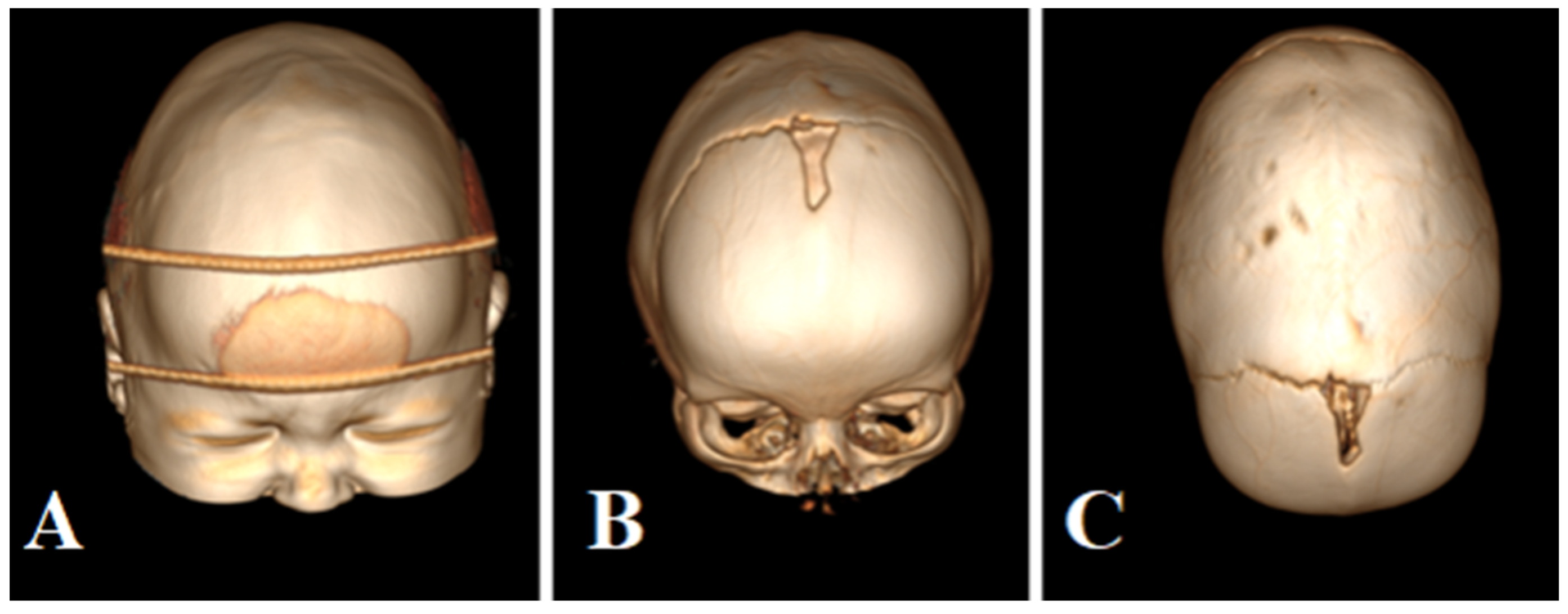 Brainsci 13 00894 g001