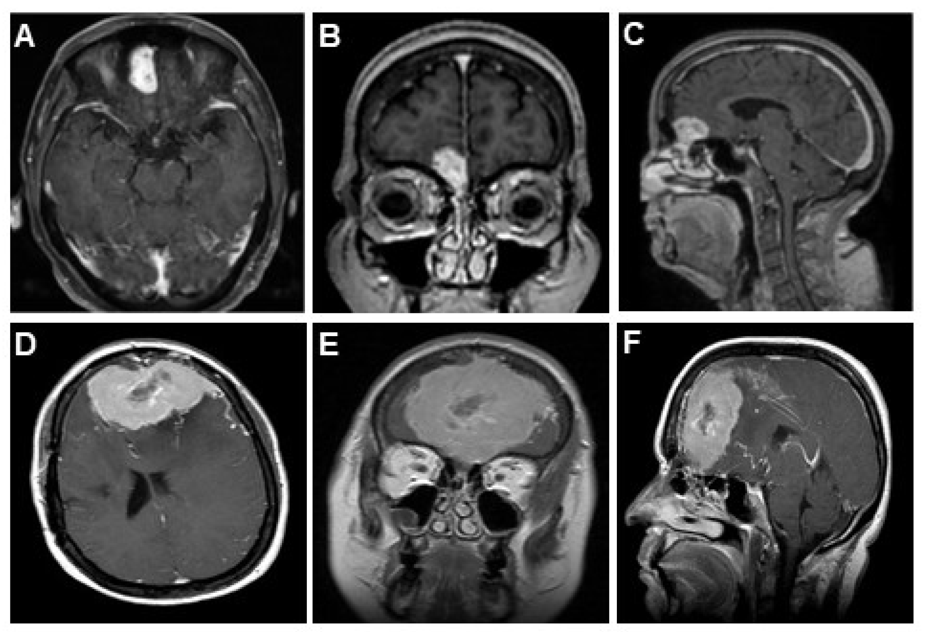 Brainsci 13 00896 g003