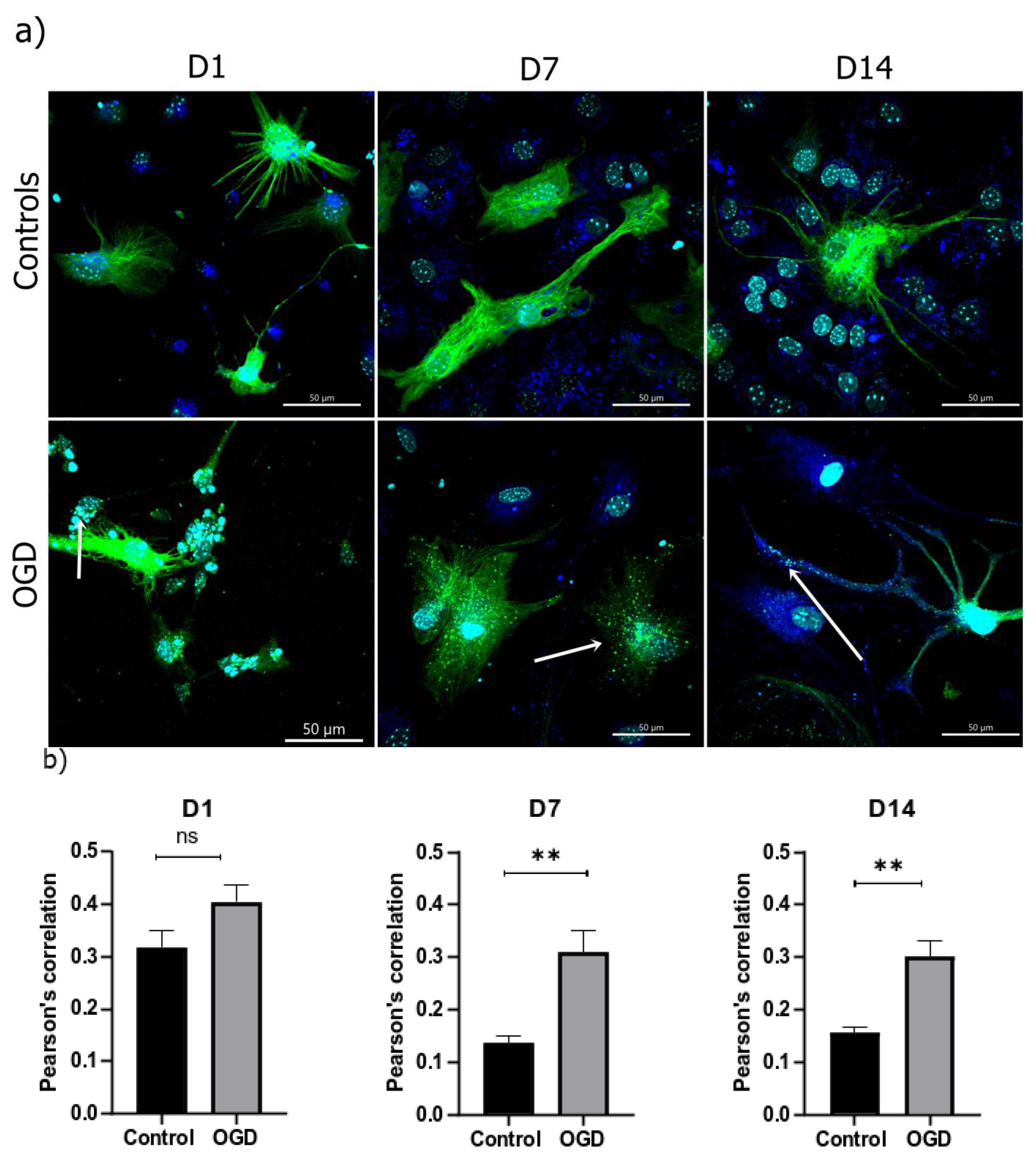 Brainsci 13 00910 g012 Brainsci 13 00910 g012