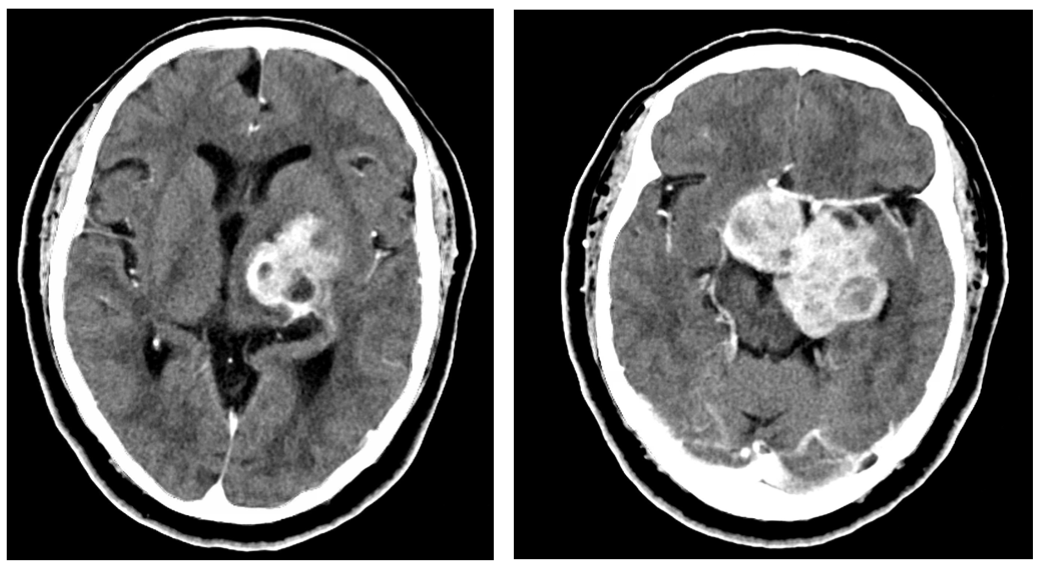 Brainsci 13 00916 g001b