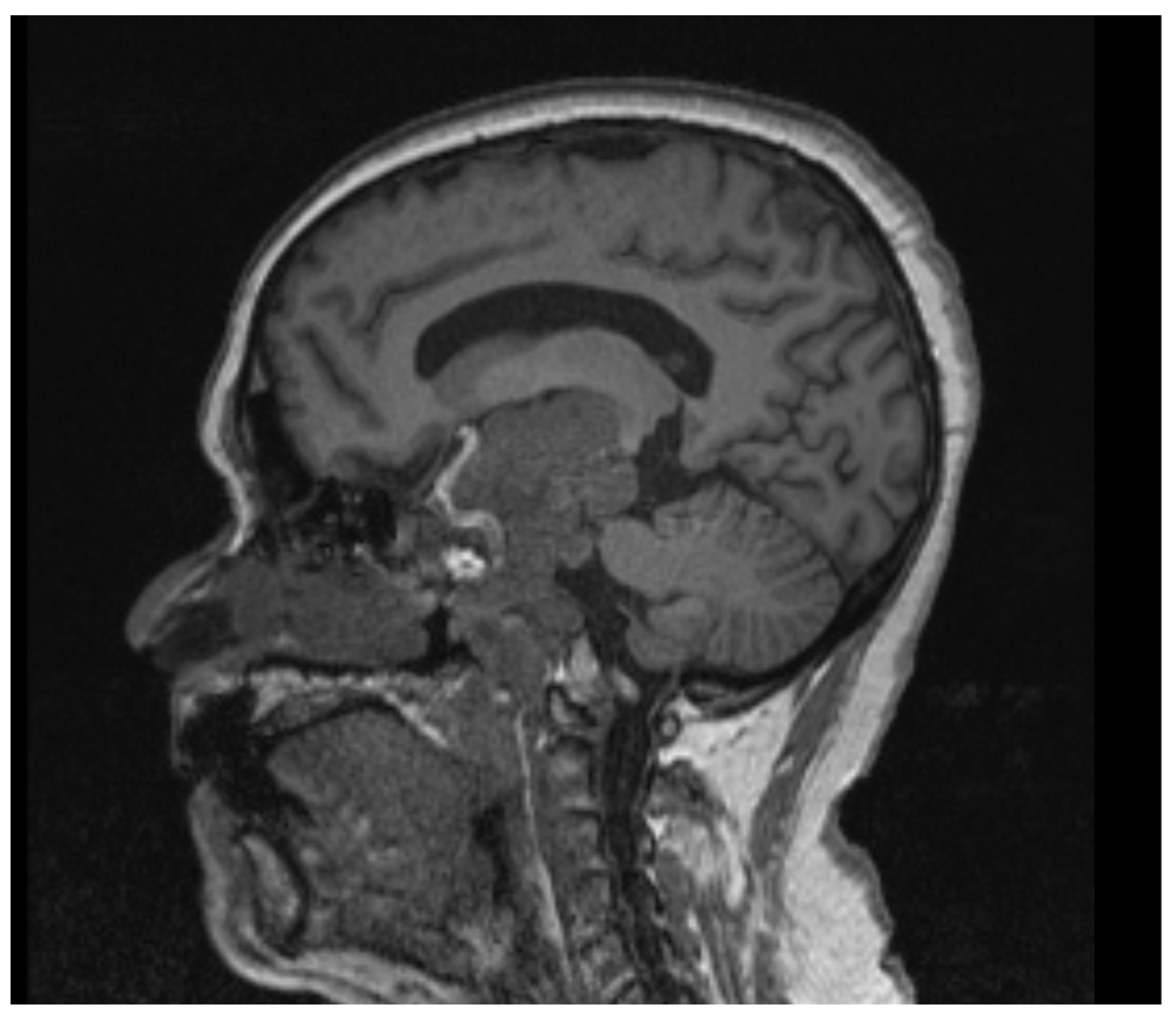 Brainsci 13 00916 g002