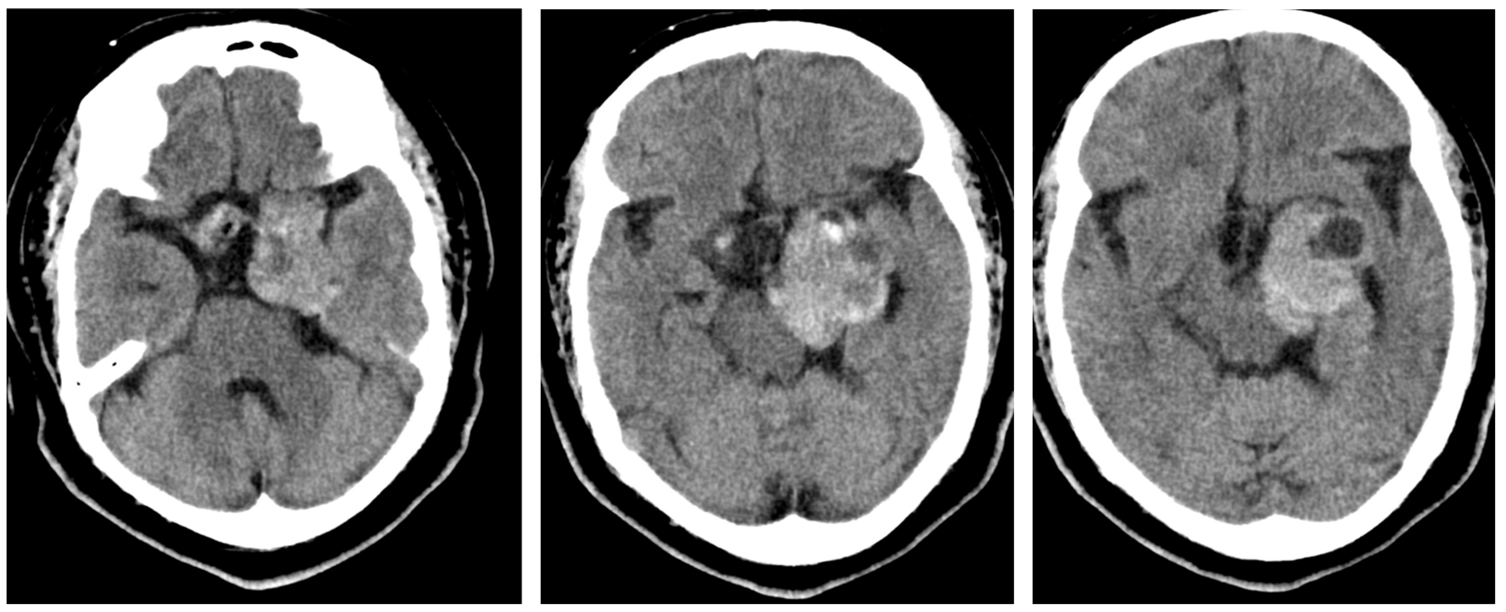 Brainsci 13 00916 g003