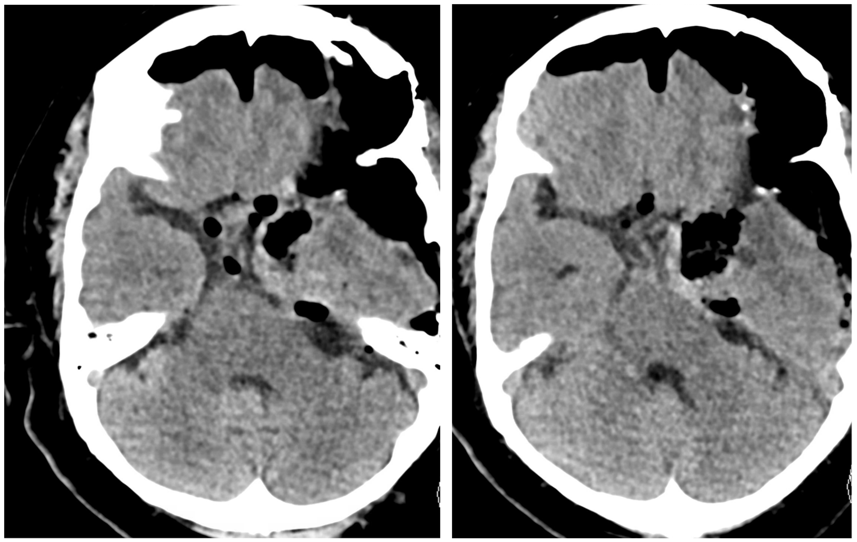 Brainsci 13 00916 g004