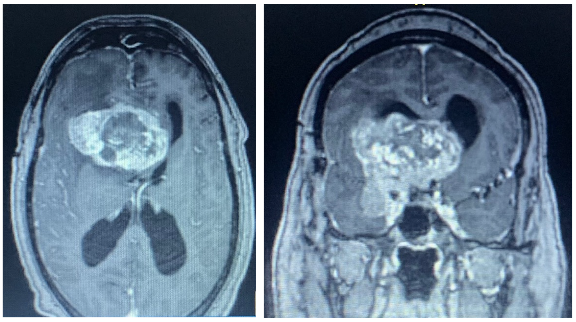 Brainsci 13 00916 g007