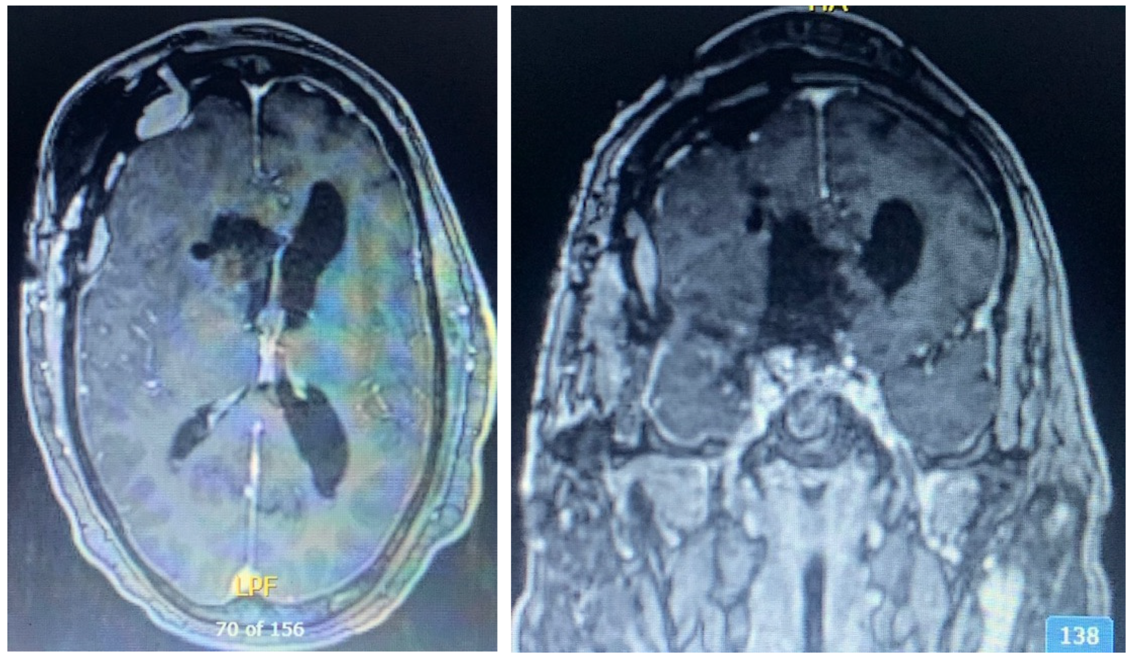 Brainsci 13 00916 g008