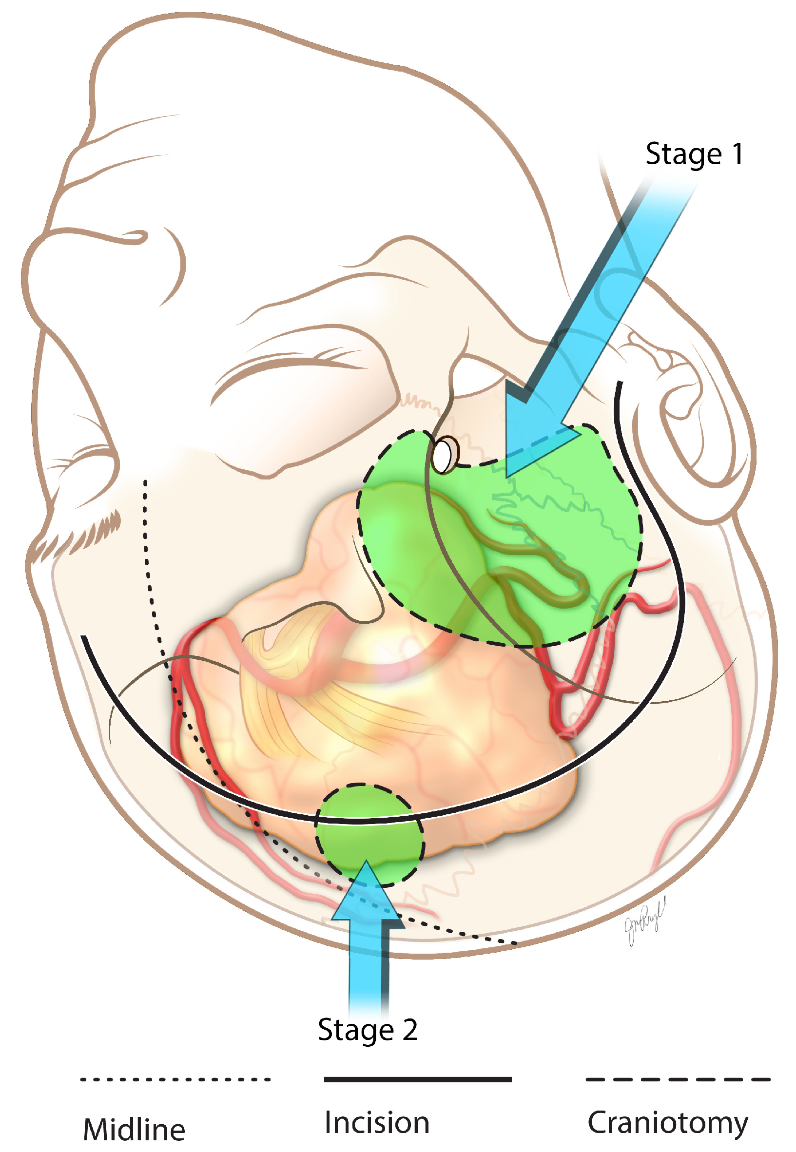 Brainsci 13 00916 g009