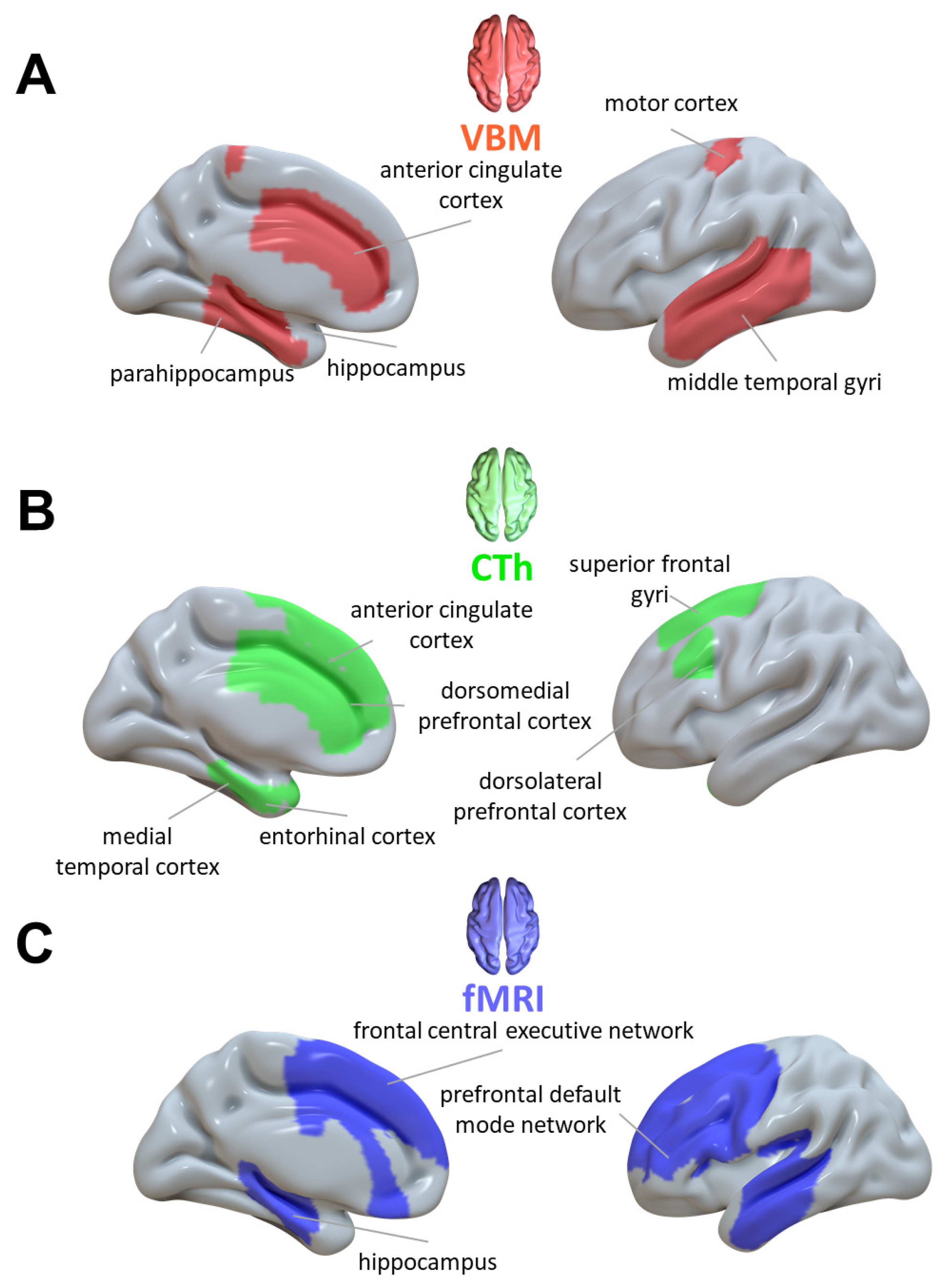 Brainsci 13 00923 g002