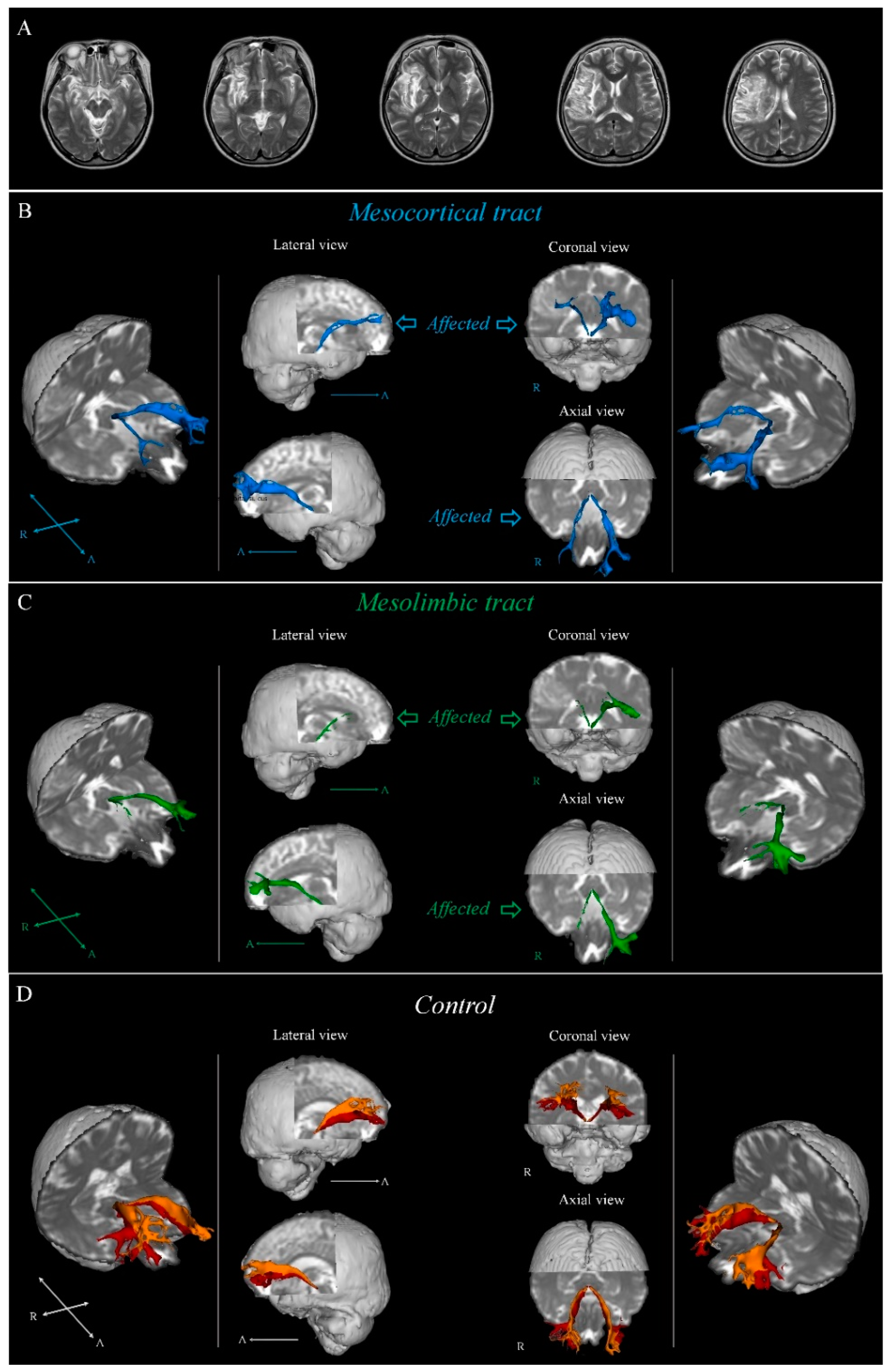 Brainsci 13 00927 g001 Brainsci 13 00927 g001