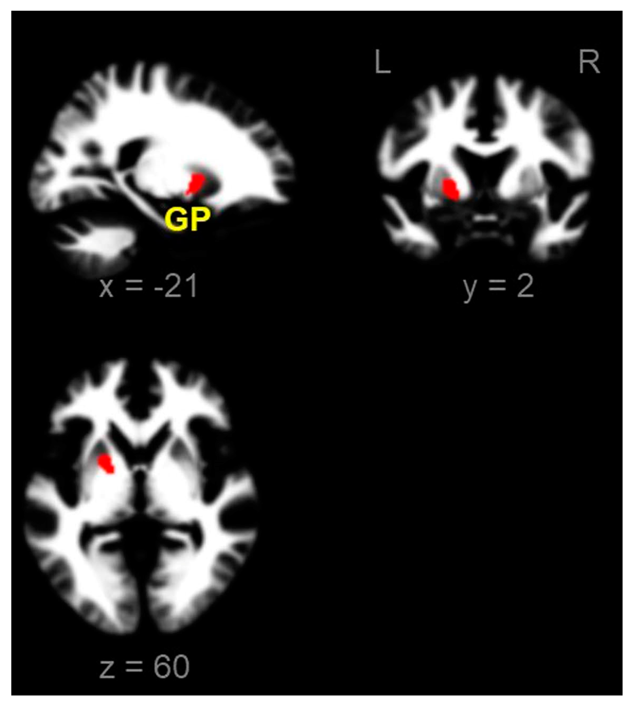 Brainsci 13 00942 g002