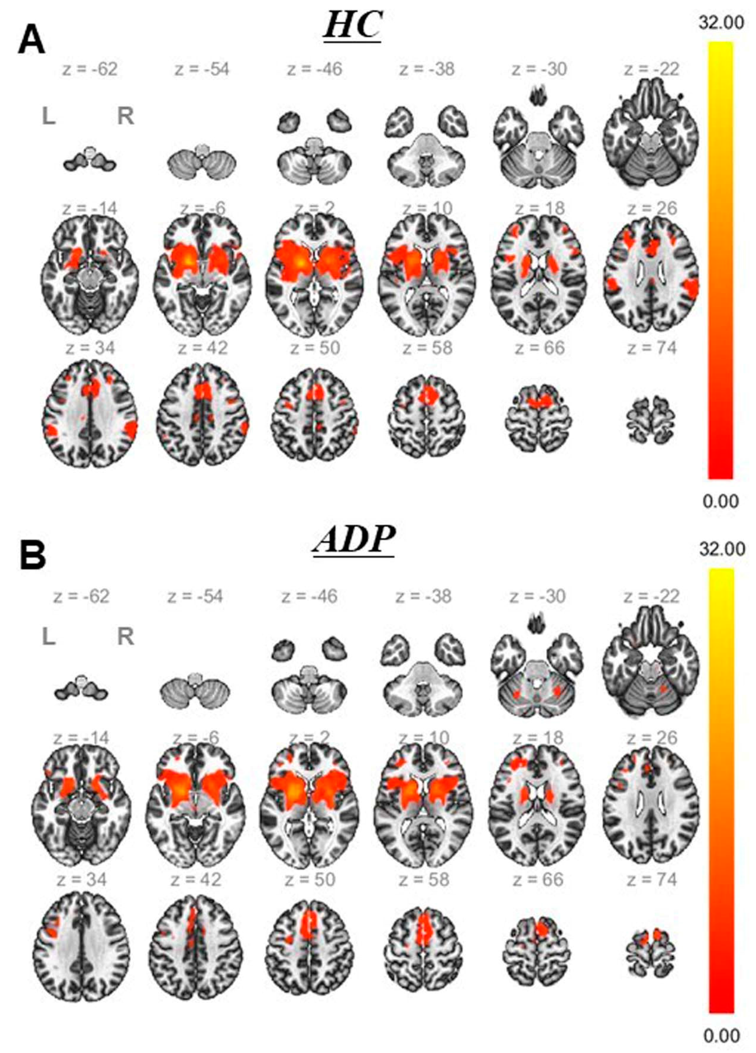 Brainsci 13 00942 g003