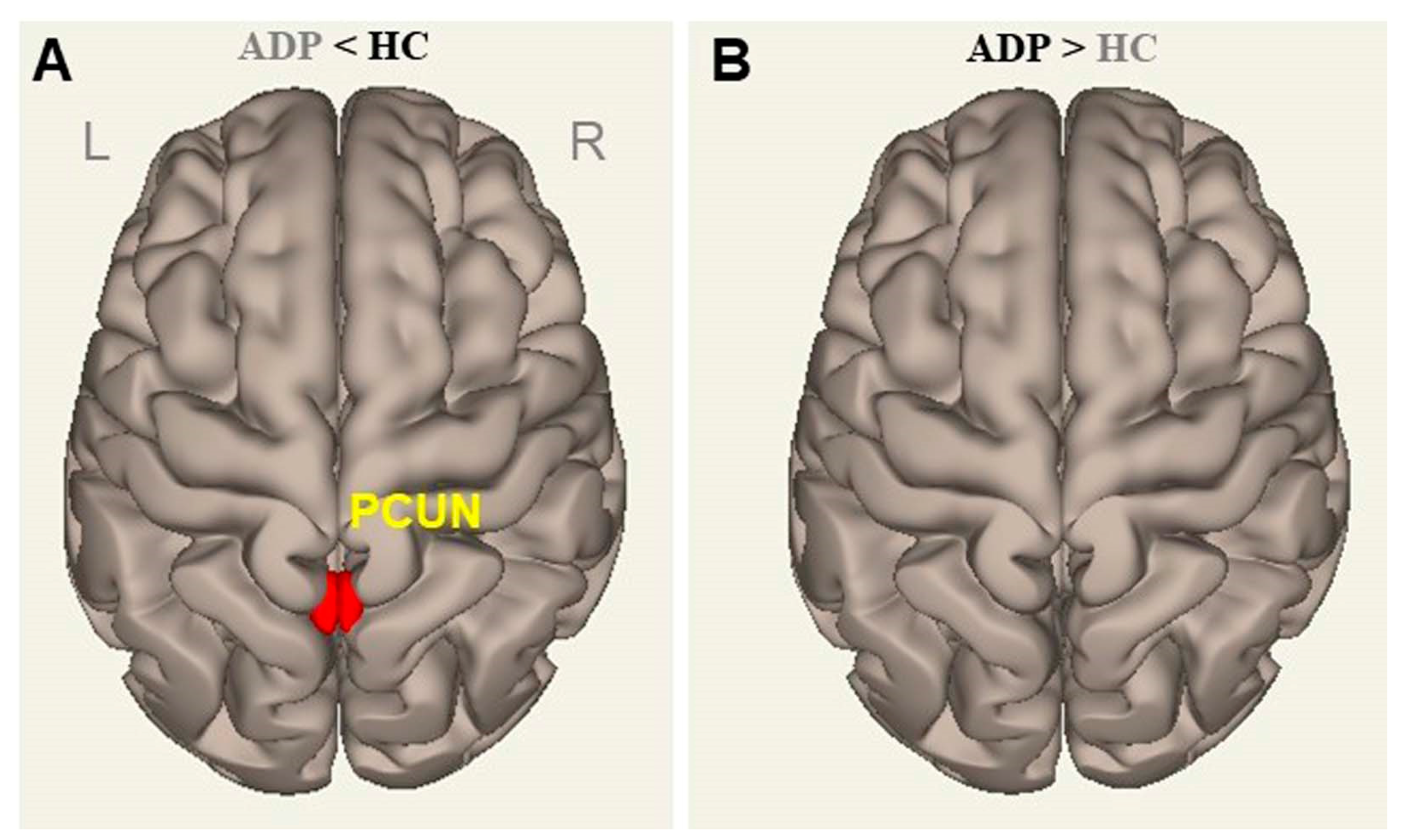 Brainsci 13 00942 g004
