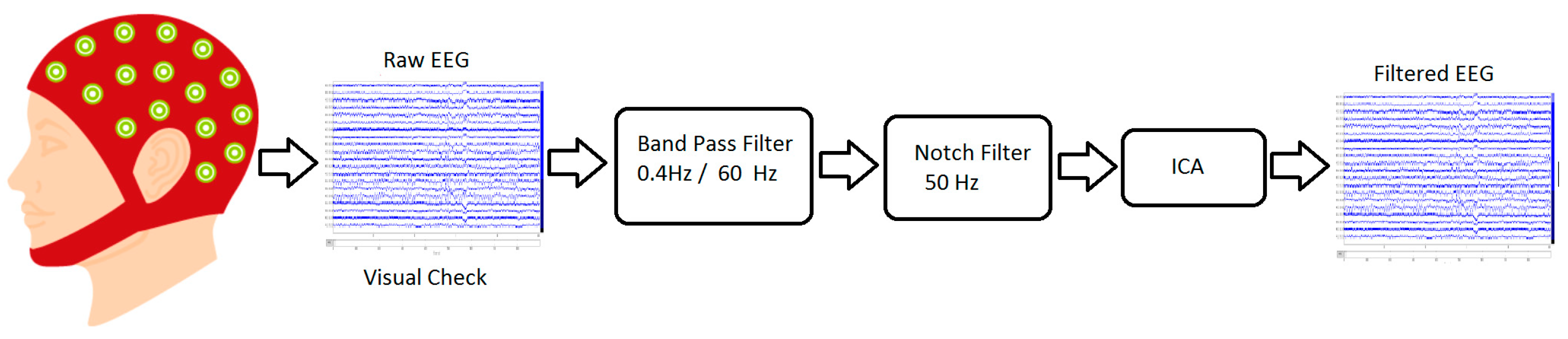 Brainsci 13 00947 g003