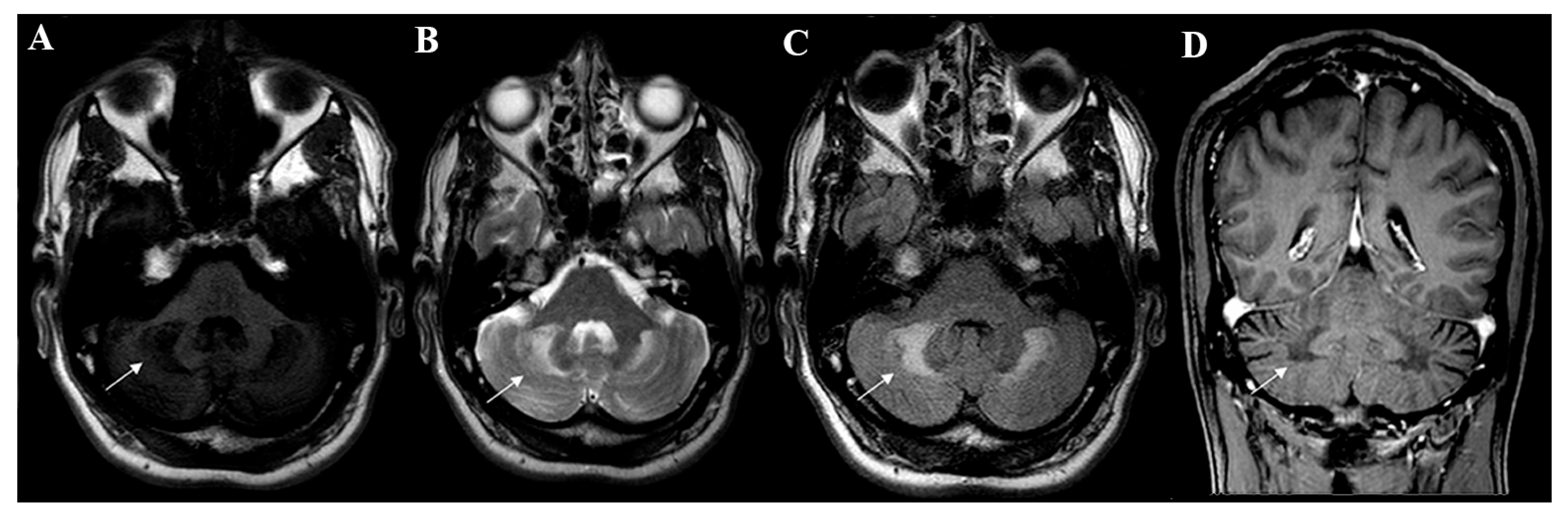 Brainsci 13 00979 g002 Brainsci 13 00979 g002