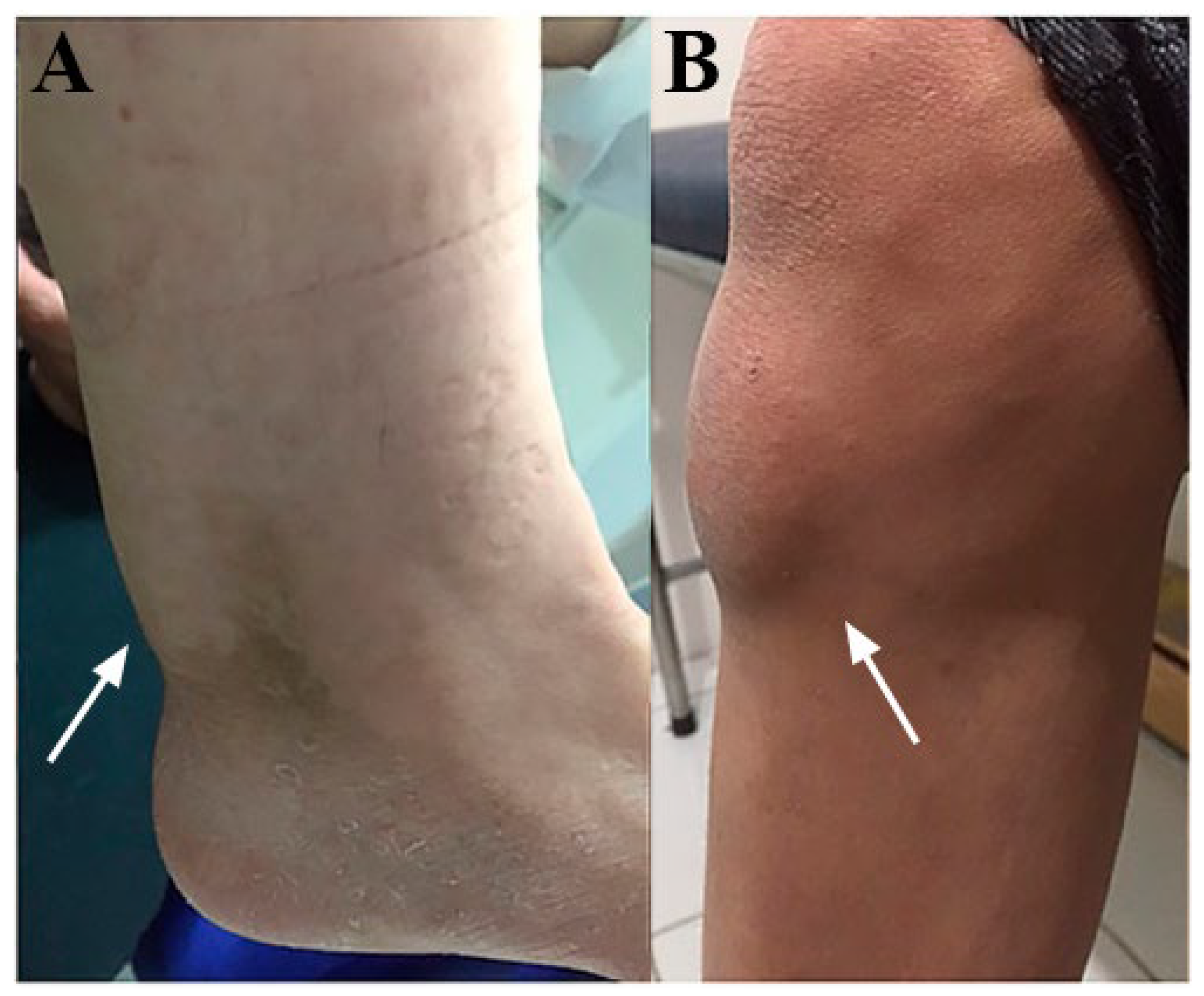 Brainsci 13 00979 g003 Brainsci 13 00979 g003