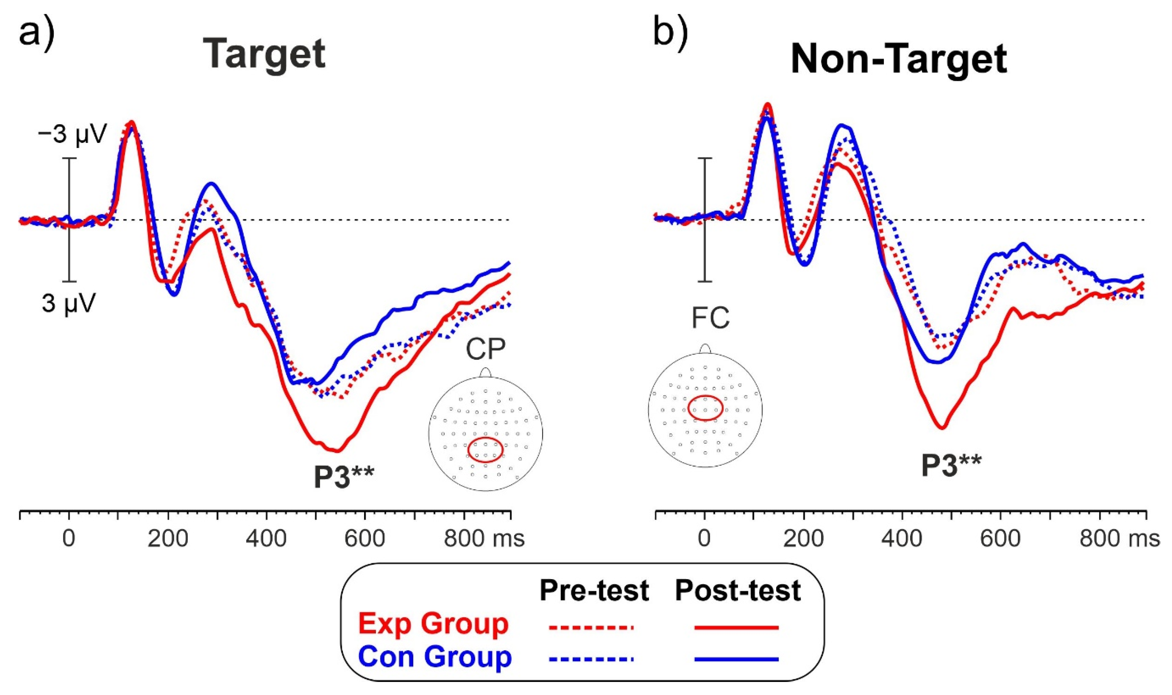 Brainsci 13 00984 g004 Brainsci 13 00984 g004