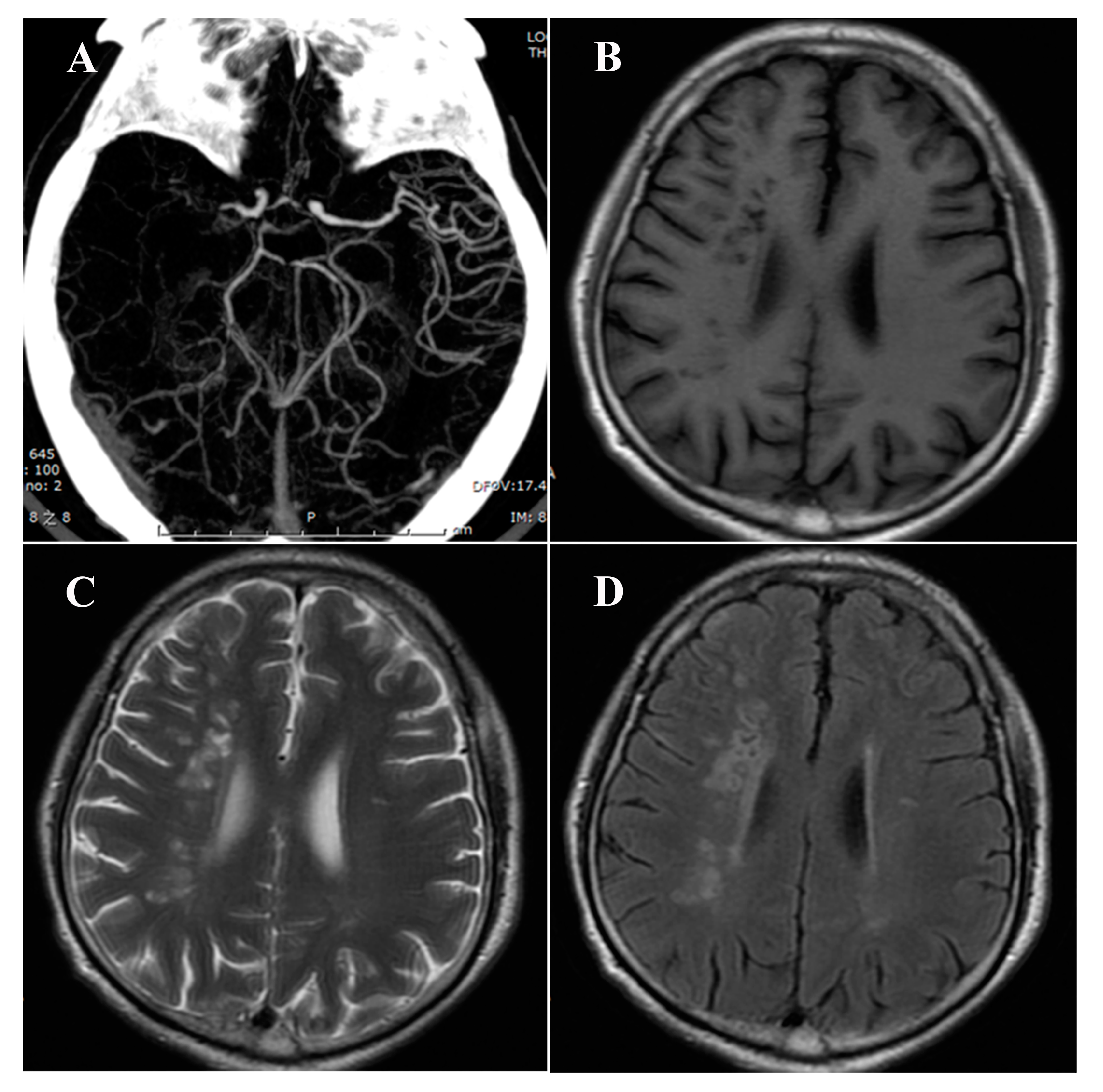 Brainsci 13 01016 g003