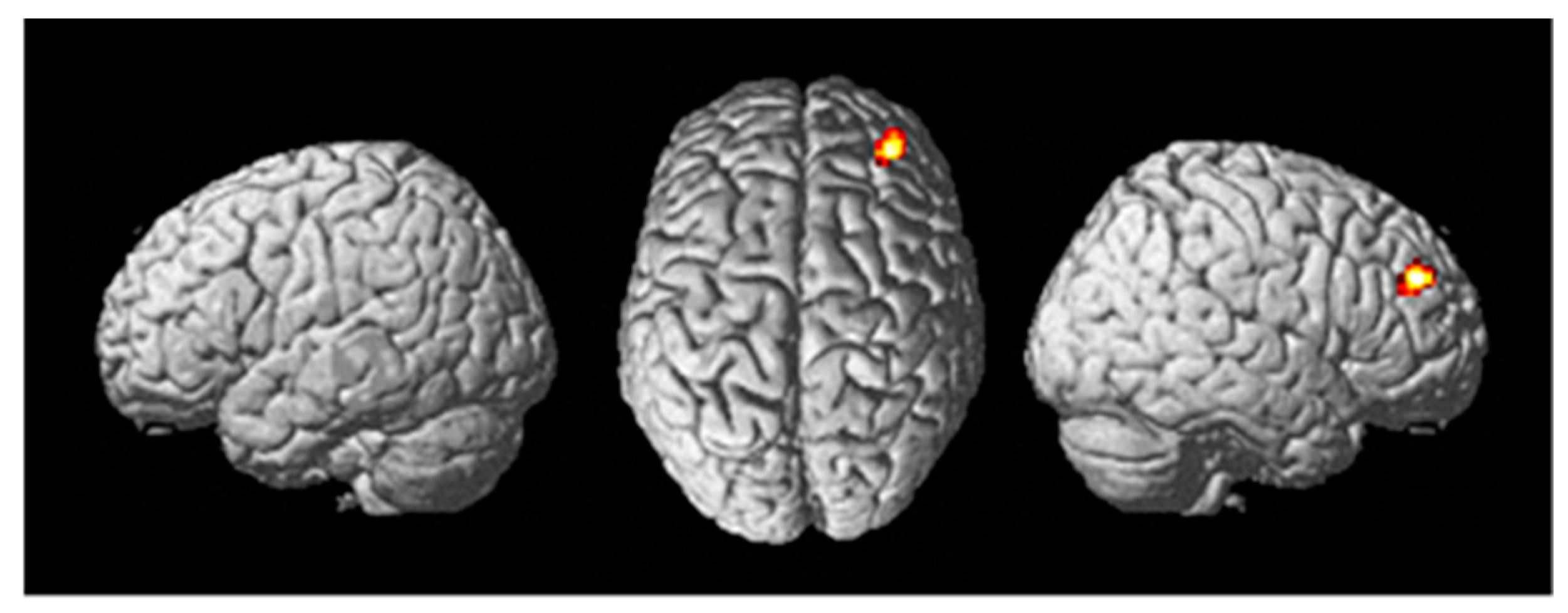 Brainsci 13 01024 g005