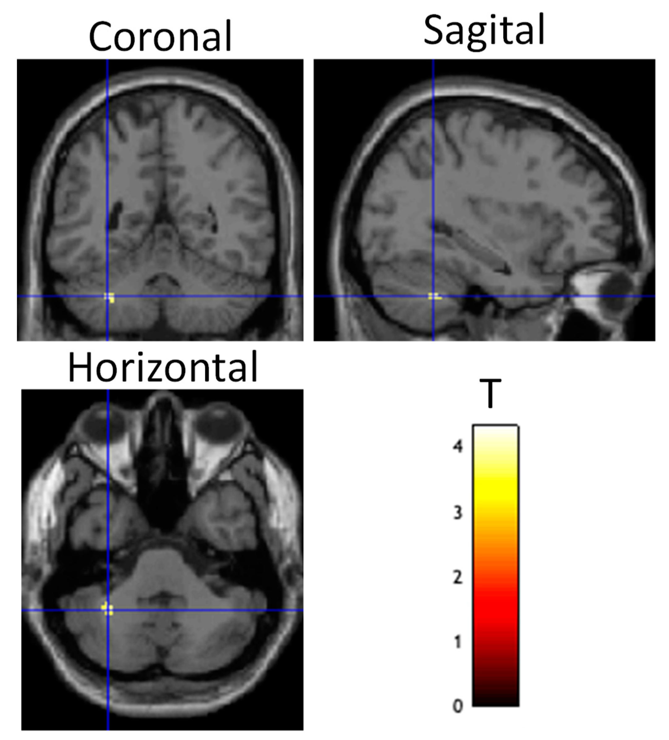 Brainsci 13 01024 g006