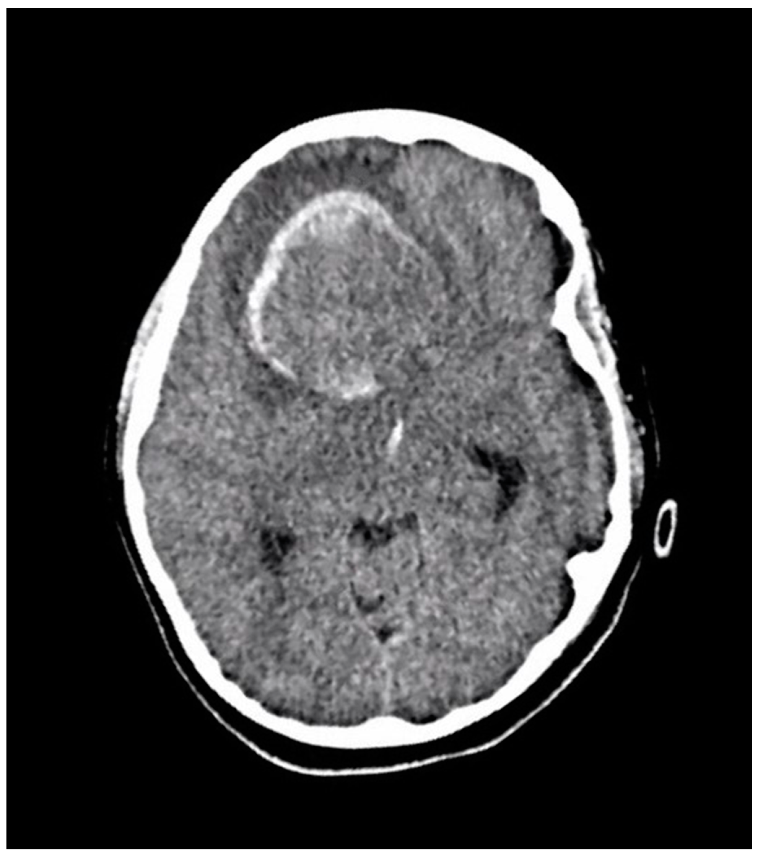 Brainsci 13 01040 g002 Brainsci 13 01040 g002