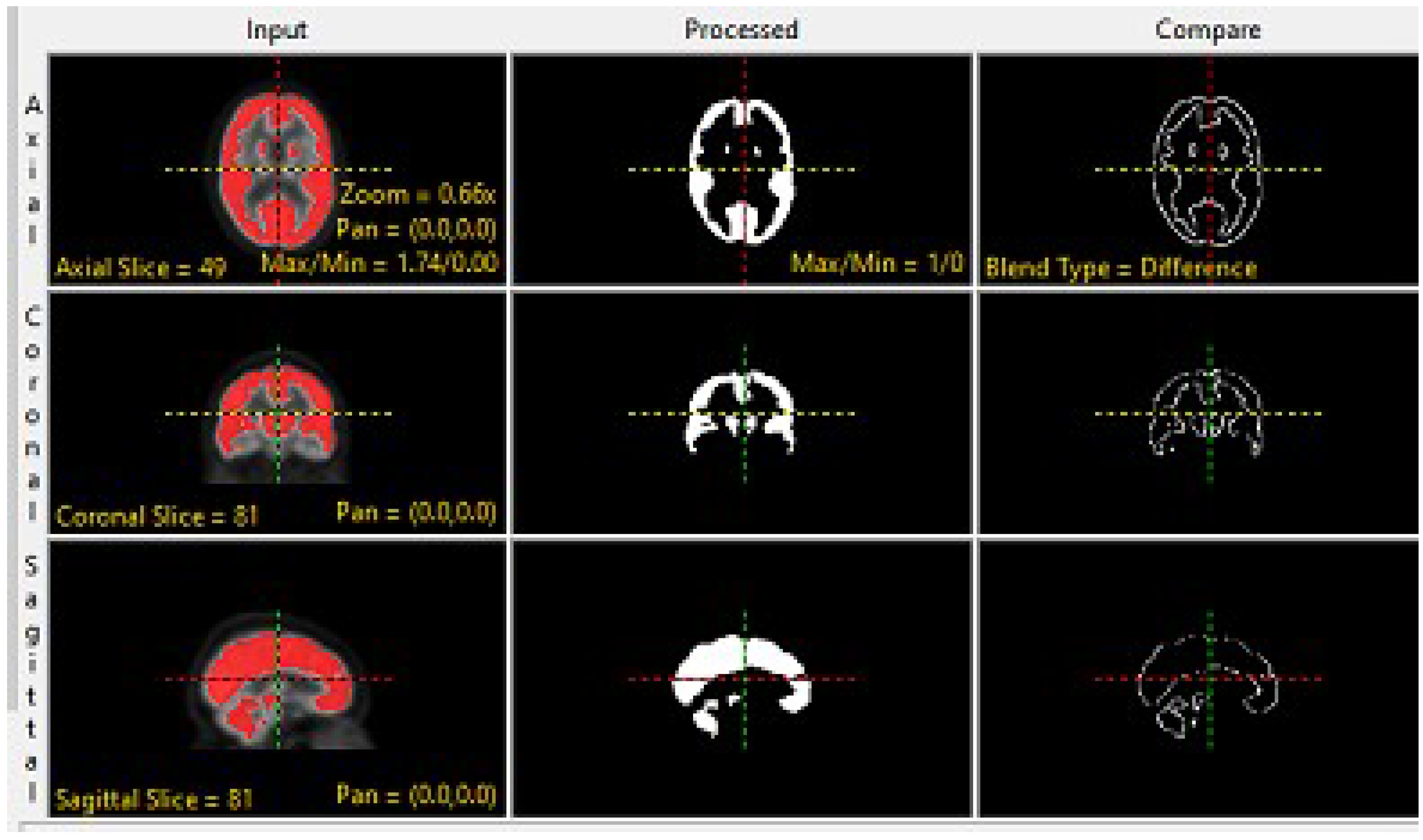 Brainsci 13 01045 g003