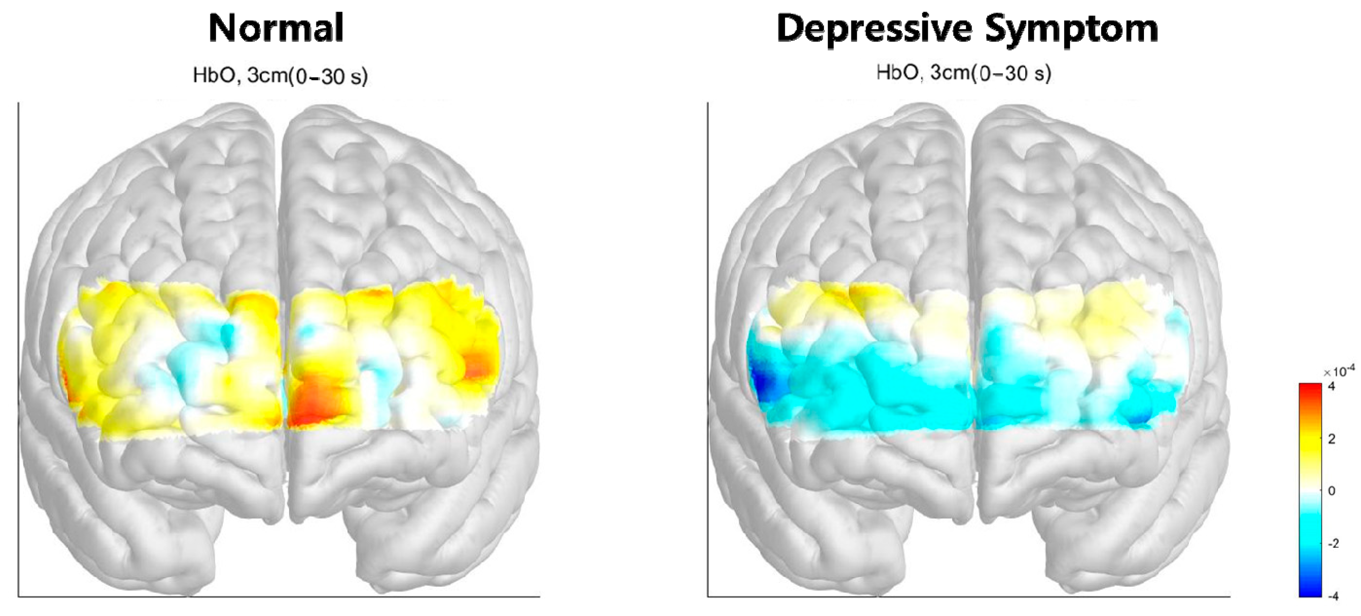 Brainsci 13 01054 g003