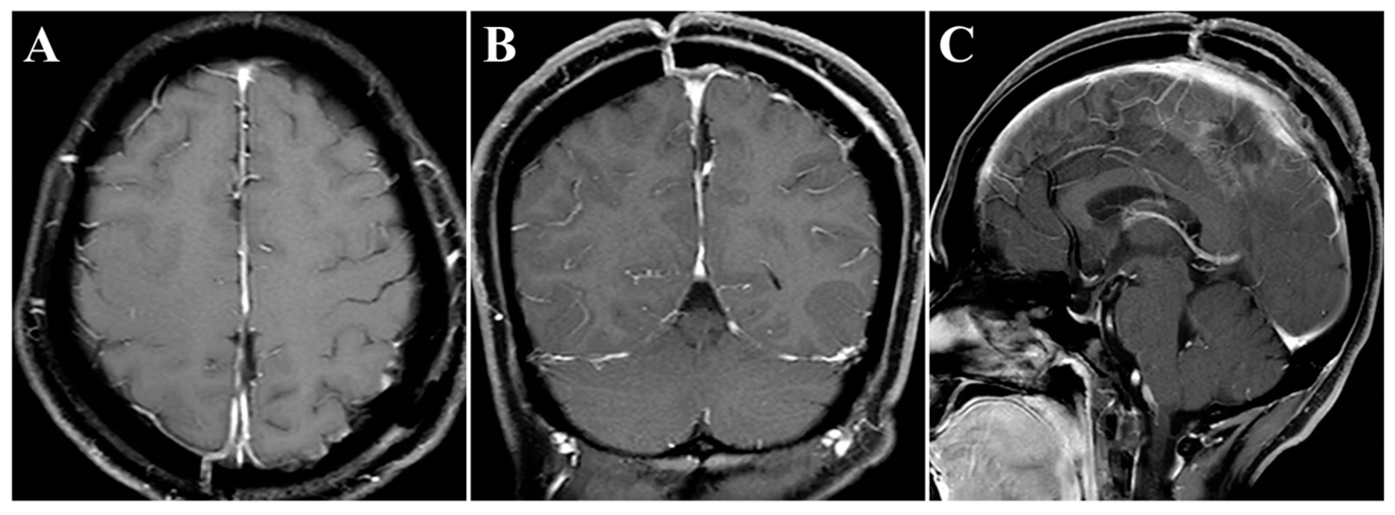 Brainsci 13 01085 g004
