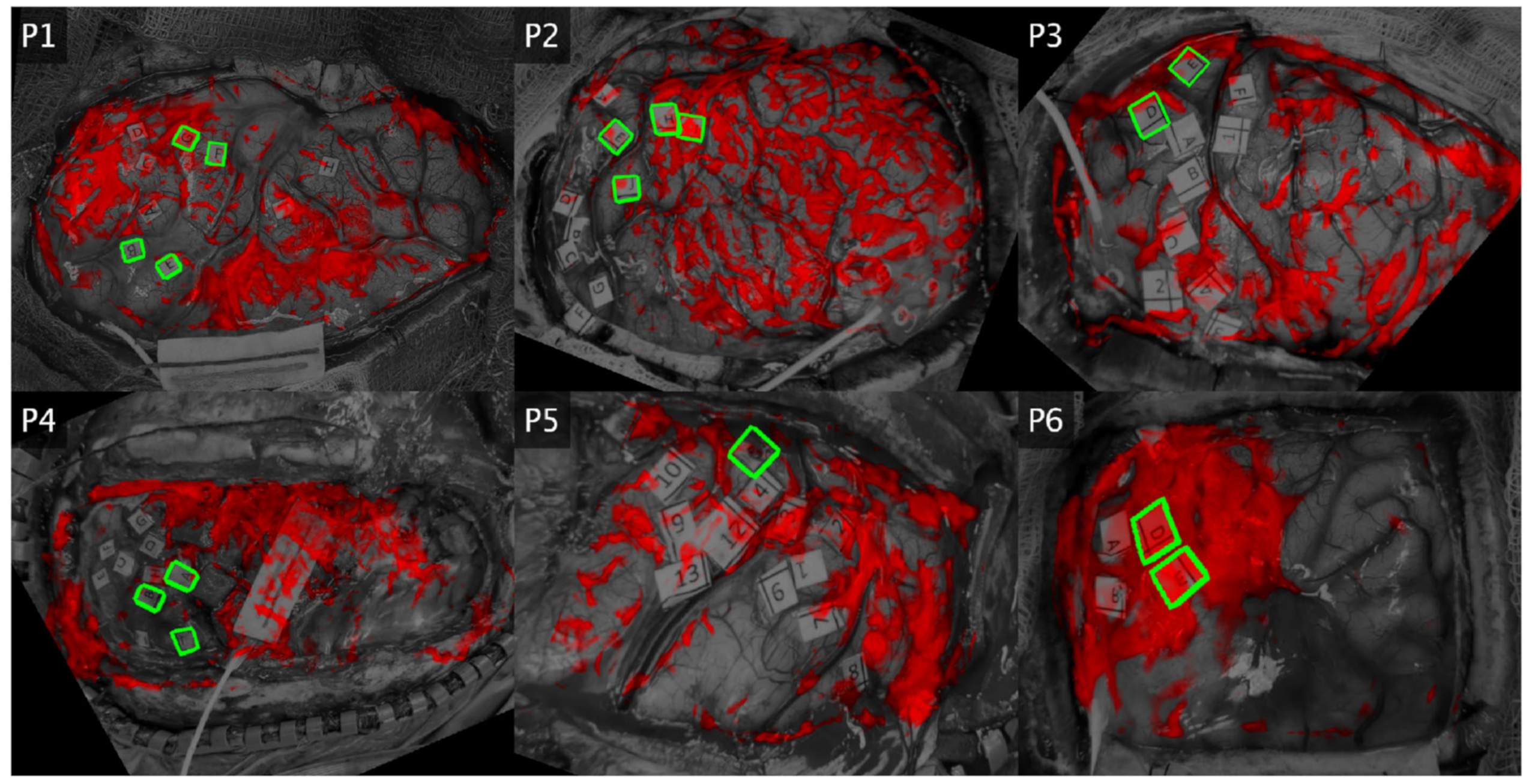 Brainsci 13 01091 g004