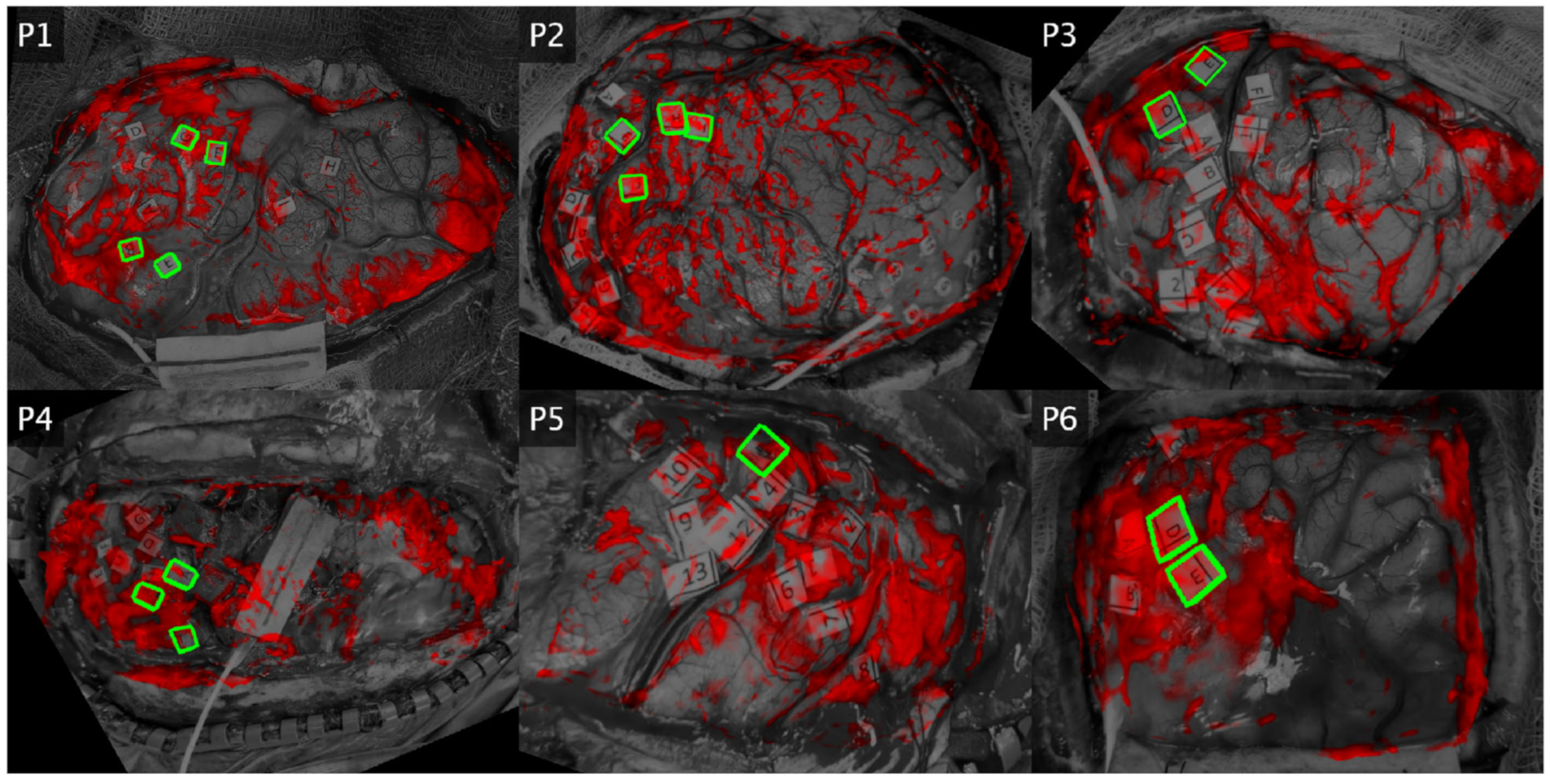 Brainsci 13 01091 g005